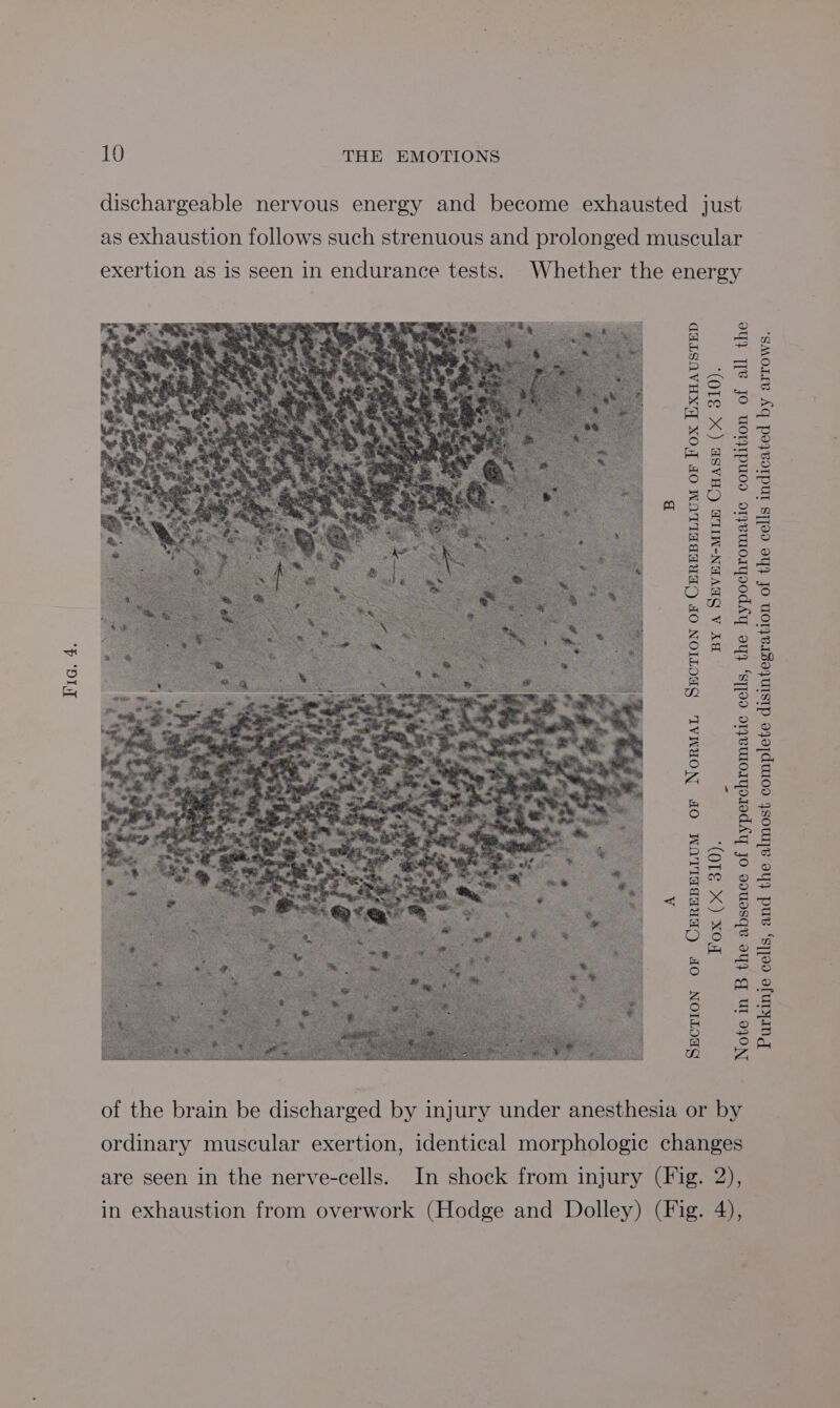 Hig: 4. dischargeable nervous energy and become exhausted just as exhaustion follows such strenuous and prolonged muscular exertion as is seen in endurance tests. Whether the energy BY A SEVEN-MILE CHASE (X 310). - Fox (x 310). Note in B the absence of hyperchromatic cells, the hypochromatic condition of all the SEcTION OF CEREBELLUM OF NORMAL SECTION OF CEREBELLUM OF Fox EXHAUSTED of the brain be discharged by injury under anesthesia or by ordinary muscular exertion, identical morphologic changes are seen in the nerve-cells. In shock from injury (Fig. 2), in exhaustion from overwork (Hodge and Dolley) (Fig. 4), Purkinje cells, and the almost complete disintegration of the cells indicated by arrows.