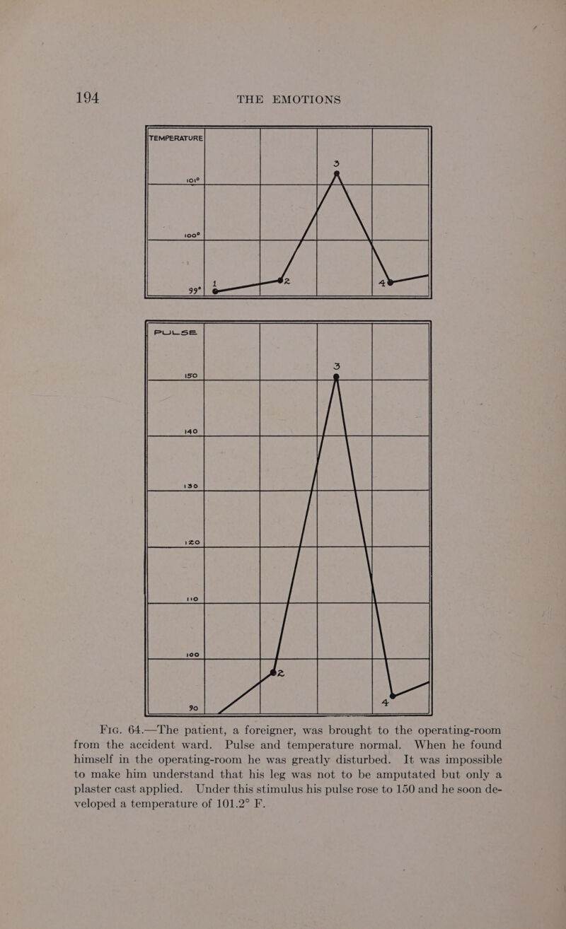 Fic. 64.—The patient, a foreigner, was brought to the operating-room from the accident ward. Pulse and temperature normal. When he found himself in the operating-room he was greatly disturbed. It was impossible to make him understand that his leg was not to be amputated but only a plaster cast applied. Under this stimulus his pulse rose to 150 and he soon de- veloped a temperature of 101.2° F.