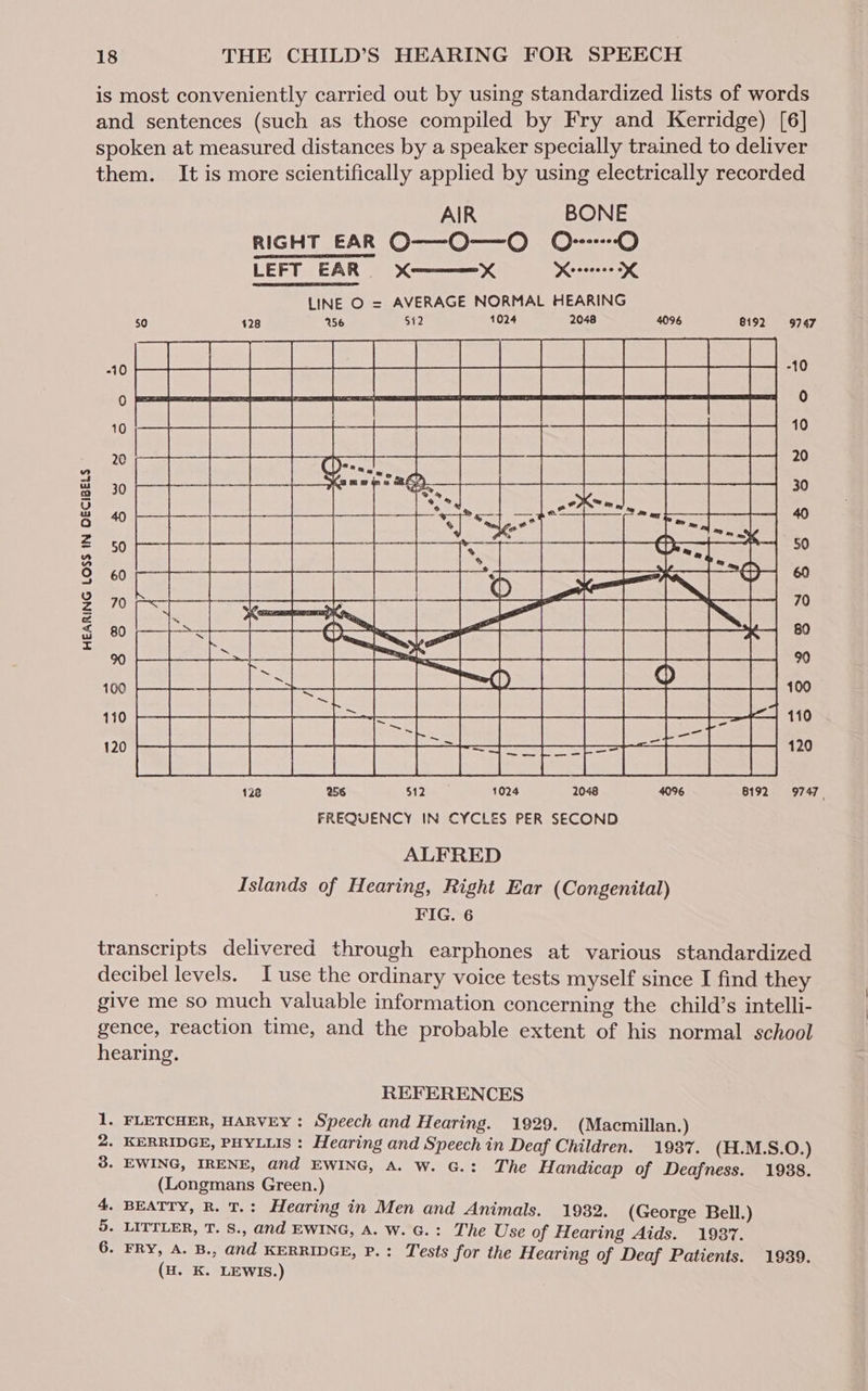 is most conveniently carried out by using standardized lists of words and sentences (such as those compiled by Fry and Kerridge) [6] spoken at measured distances by a speaker specially trained to deliver them. It is more scientifically applied by using electrically recorded -~_ ary © 128 256 S12 5 1024 2048 4096 8192-9747, FREQUENCY IN CYCLES PER SECOND ALFRED Islands of Hearing, Right Ear (Congenital) FIG. 6 transcripts delivered through earphones at various standardized decibel levels. I use the ordinary voice tests myself since I find they give me so much valuable information concerning the child’s intelli- gence, reaction time, and the probable extent of his normal school hearing. REFERENCES - FLETCHER, HARVEY : Speech and Hearing. 1929. (Macmillan.) . KERRIDGE, PHYLLIS : Hearing and mas in Deaf Children. 1987. (H.M.S.O.) - EWING, IRENE, and EWING, A. W. G.: The Handicap of Deafness. 1988. (Longmans Green.) - BEATTY, R. T.: Hearing in Men and Animals. 1982. (George Bell.) - LITTLER, T. S., and EWING, A. W. G.: The Use of Hearing Aids. 1987. - FRY, A. B., €nd KERRIDGE, P.: Tests for the Hearing of Deaf Patients. 1939. (H. K. LEWIS.) Qh = OU