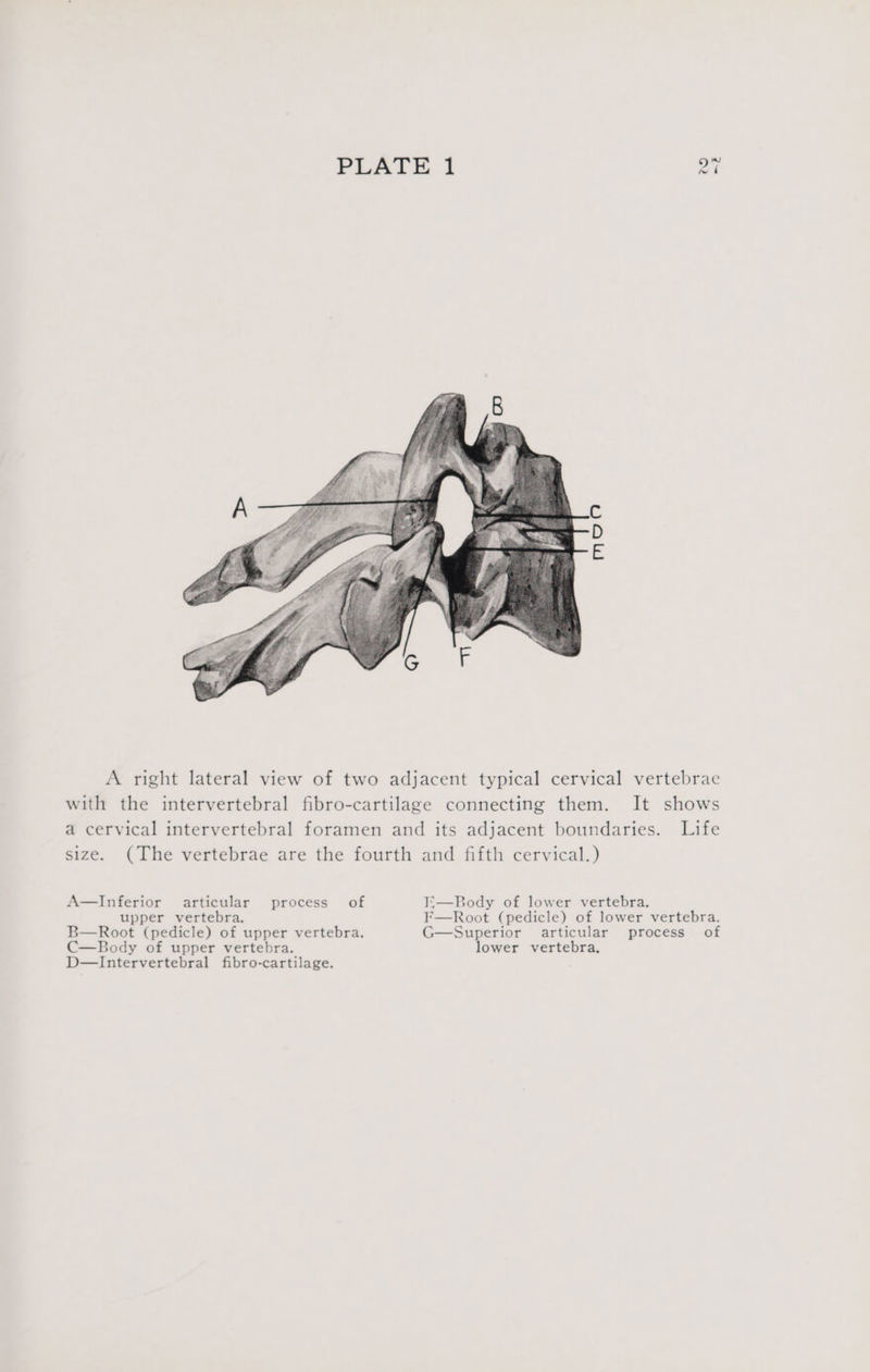 Ca) -2 A right lateral view of two adjacent typical cervical vertebrae with the intervertebral fibro-cartilage connecting them. It shows a cervical intervertebral foramen and its adjacent boundaries. Life size. (The vertebrae are the fourth and fifth cervical.) A—Inferior articular process of I;—Body of lower vertebra. upper vertebra, F—Root (pedicle) of lower vertebra. B—Root (pedicle) of upper vertebra. G—Superior articular process of C—Body of upper vertebra. lower vertebra.