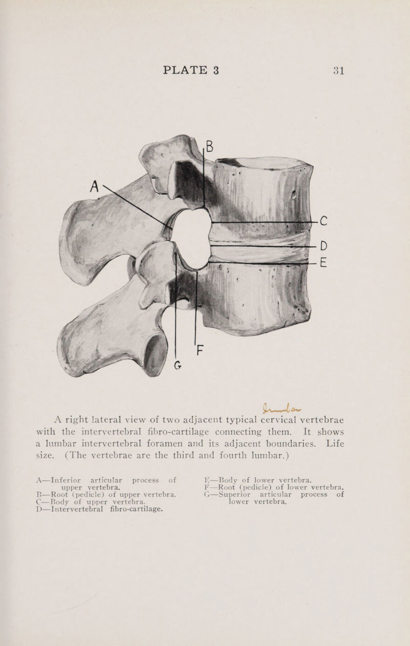 A—Inferior articular process of I;—Body of lower vertebra. upper vertebra. F—Root (pedicle) of lower vertebra. 3—Root (pedicle) of upper vertebra. G—Superior articular process of C—Body of upper vertebra. lower vertebra,