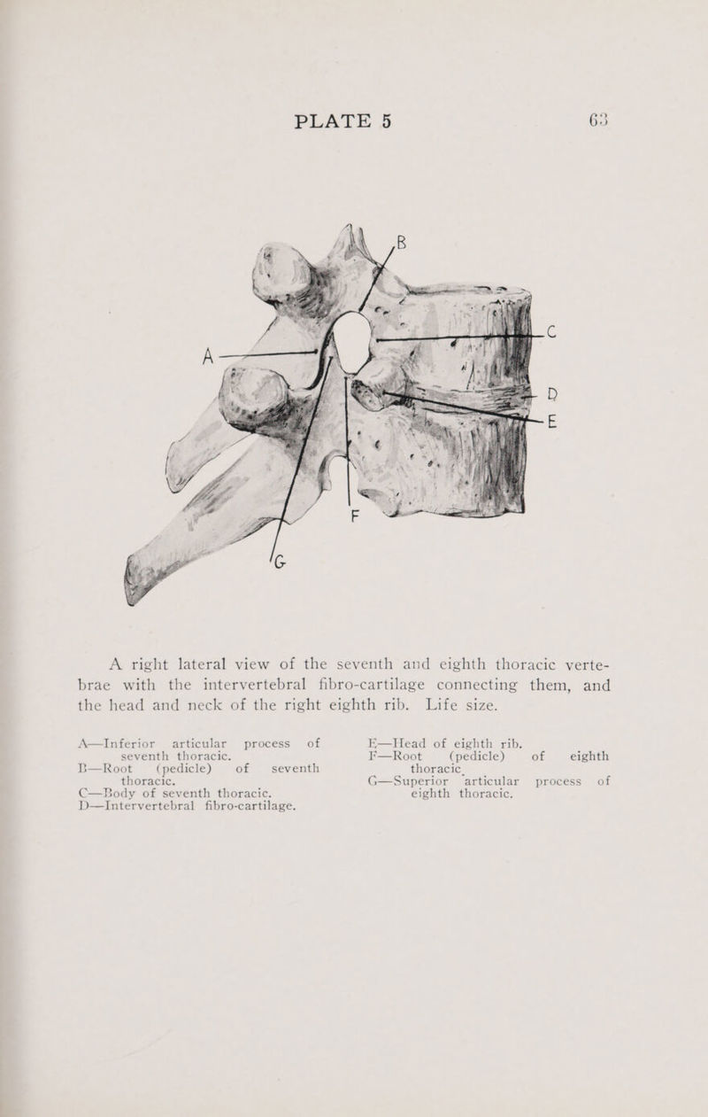 A right lateral view of the seventh and eighth thoracic verte- brae with the intervertebral fibro-cartilage connecting them, and the head and neck of the right eighth rib. Life size. A—Inferior articular process of E—Head of eighth rib. seventh thoracic. F—Root (pedicle) of eighth B—Root (pedicle) of seventh thoracic. thoracic. G—Superior articular process of C—Body of seventh thoracic. eighth thoracic. D—Intervertebral fibro-cartilage.