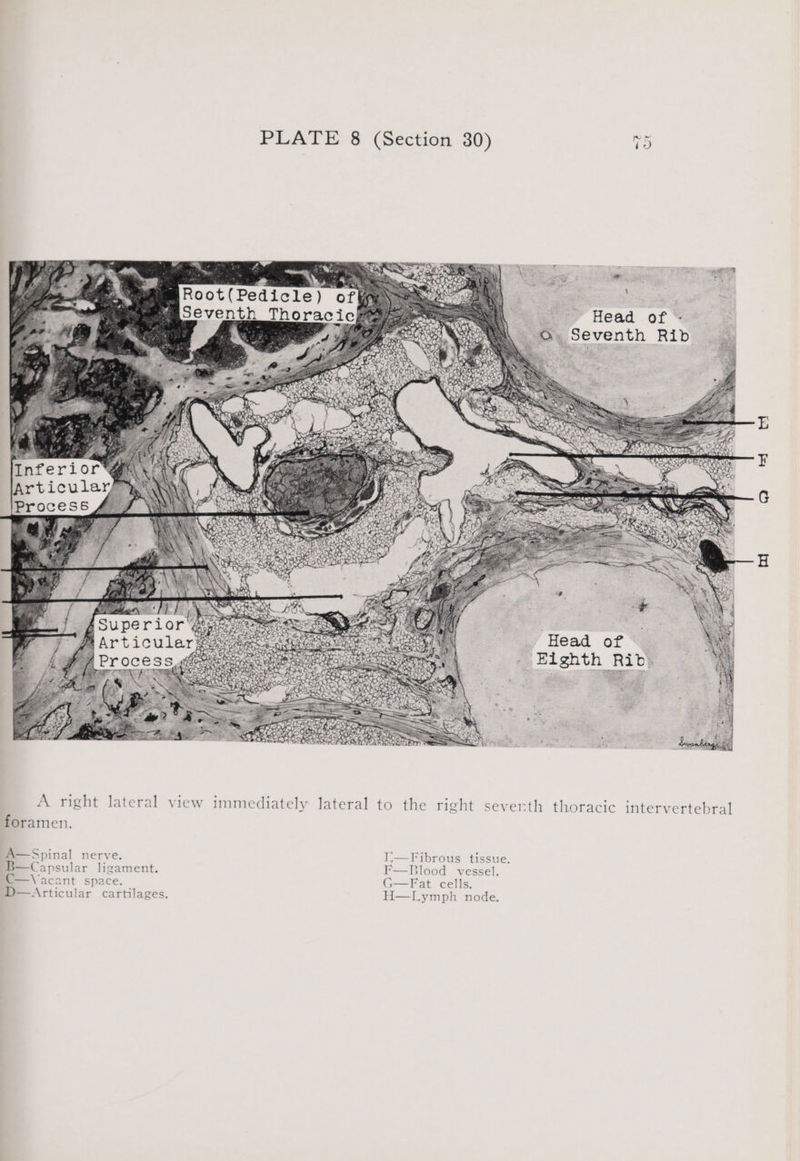 PLATE 8 (Section 30) * * >Sasmenet Root(Pedicle) of Articularg Toe SHOP ne yh Head of Process rOe cee, === «Eighth Rid) a A right lateral view immediately lateral to the right seventh thoracic intervertebral foramen. A—Spinal nerve. I'_—Fibrous tissue. B—Capsular ligament. I'—Blood vessel. C—Vacant space. G—Fat cells. D—Articular cartilages. H—Lymph node.