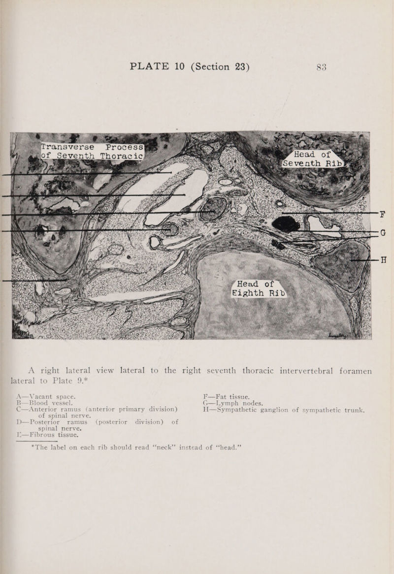 ransverse A right lateral view lateral to the right seventh thoracic intervertebral foramen lateral to Plate 9.* A—Vacant space. F—Fat tissue. B—Blood vessel. G—Lymph nodes. C—Anterior ramus (anterior primary division) H—Sympathetic ganglion of sympathetic trunk. of spinal nerve. D—Posterior ramus (posterior division) of spinal nerve. I:—Fibrous tissue. *The label on each rib should read ‘‘neck’’ instead of ‘‘head.’’