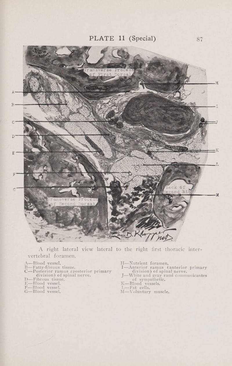 PLATE 11 (Special) 37 A right lateral view lateral to the right first thoracic inter- vertebral foramen. A—Blood vessel. II—Nutrient foramen. B—Fatty-fibrous tissue. I—Anterior ramus (anterior primary C—Posterior ramus (posterior primary division) of spinal nerve. division) of spinal nerve. J—White and gray rami communicantes I)—Fibrous tissue. of sympathetic. I<—Blood vessel. K—Blood vessels. F—Blood vessel. I.—Fat cells. G—Blood vessel. M—Voluntary muscle,