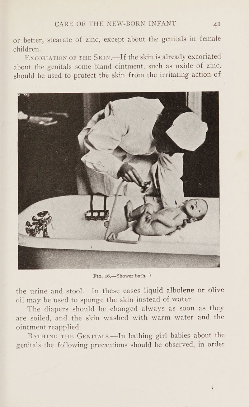 or better, stearate of zinc, except about the genitals in female children. EXCORIATION OF THE SKIN.—If the skin is already excoriated about the genitals some bland ointment, such as oxide of zinc, should be used to protect the skin from the irritating action of the urine and stool. In these cases liquid albolene or olive oil may be used to sponge the skin instead of water. The diapers should be changed always as soon as they are soiled, and the skin washed with warm water and the ointment reapplied. 3ATHING THE GENITALS.—In bathing girl babies about the genitals the following precautions should be observed, in order