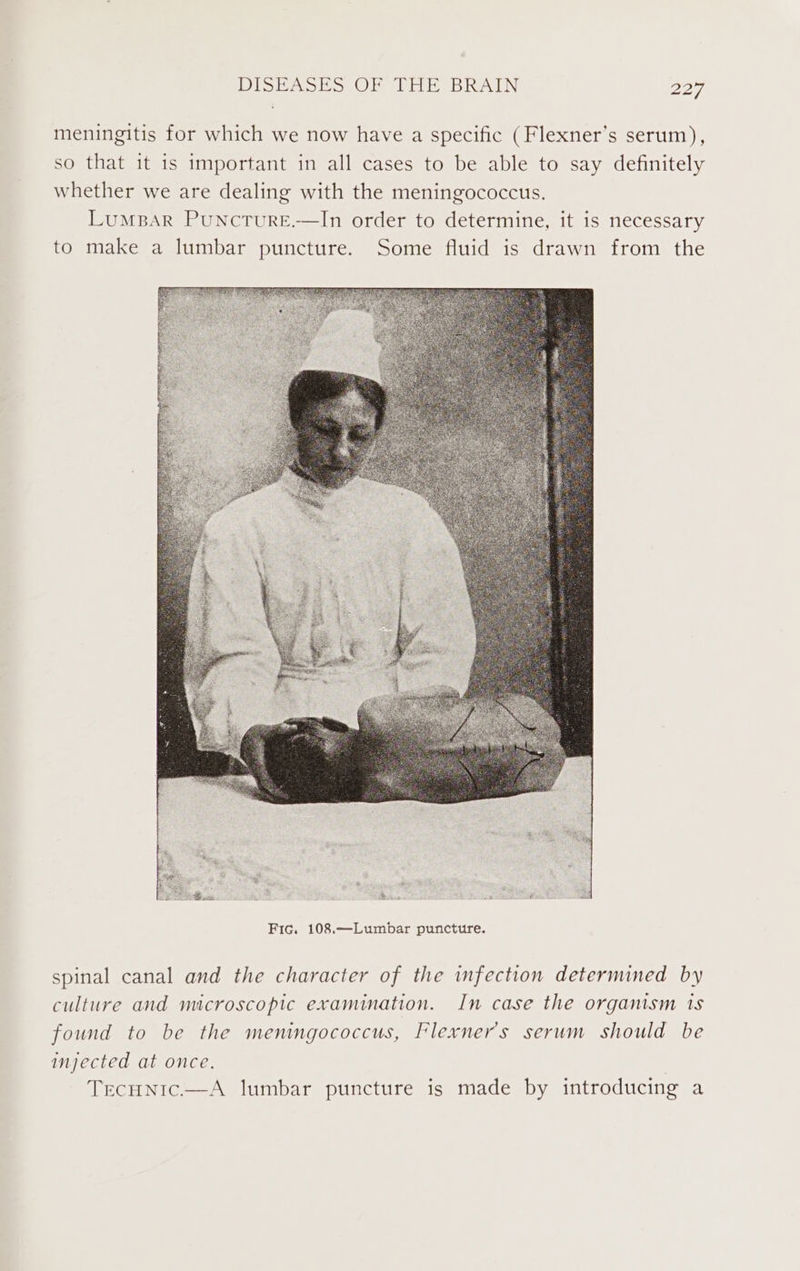 meningitis for which we now have a specific (Flexner’s serum), so that it is important in all cases to be able to say definitely whether we are dealing with the meningococcus. LuMmBaAR PunctTurE.—In order to determine, it is necessary to make a lumbar puncture. Some fluid is drawn from the Bins he Lit a ae Fic. 108.—Lumbar puncture. spinal canal and the character of the infection determined by culture and microscopic examination. In case the organism 1s found to be the meningococcus, Flexners serum should be injected at once. Tecunic.—A lumbar puncture is made by introducing a