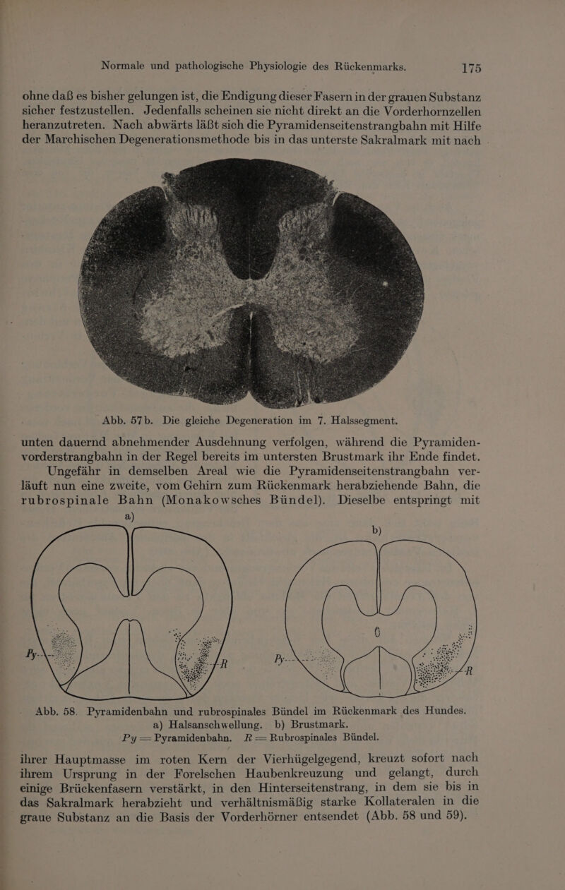ohne daß es bisher gelungen ist, die Endigung dieser Fasern in der grauen Substanz sicher festzustellen. Jedenfalls scheinen sie nicht direkt an die Vorderhornzellen heranzutreten. Nach abwärts läßt sich die Pyramidenseitenstrangbahn mit Hilfe der Marchischen Degenerationsmethode bis in das unterste Sakralmark mit nach . Abb. 57b. Die gleiche Degeneration im 7. Halssegment. unten dauernd abnehmender Ausdehnung verfolgen, während die Pyramiden- vorderstrangbahn in der Regel bereits im untersten Brustmark ihr Ende findet. Ungefähr in demselben Areal wie die Pyramidenseitenstrangbahn ver- läuft nun eine zweite, vom Gehirn zum Rückenmark herabziehende Bahn, die rubrospinale Bahn (Monakowsches Bündel). Dieselbe entspringt mit a) ihrer Hauptmasse im roten Kern der Vierhügelgegend, kreuzt sofort nach ihrem Ursprung in der Forelschen Haubenkreuzung und gelangt, durch einige Brückenfasern verstärkt, in den Hinterseitenstrang, in dem sie bis in das Sakralmark herabzieht und verhältnismäßig starke Kollateralen in die graue Substanz an die Basis der Vorderhörner entsendet (Abb. 58 und 59).