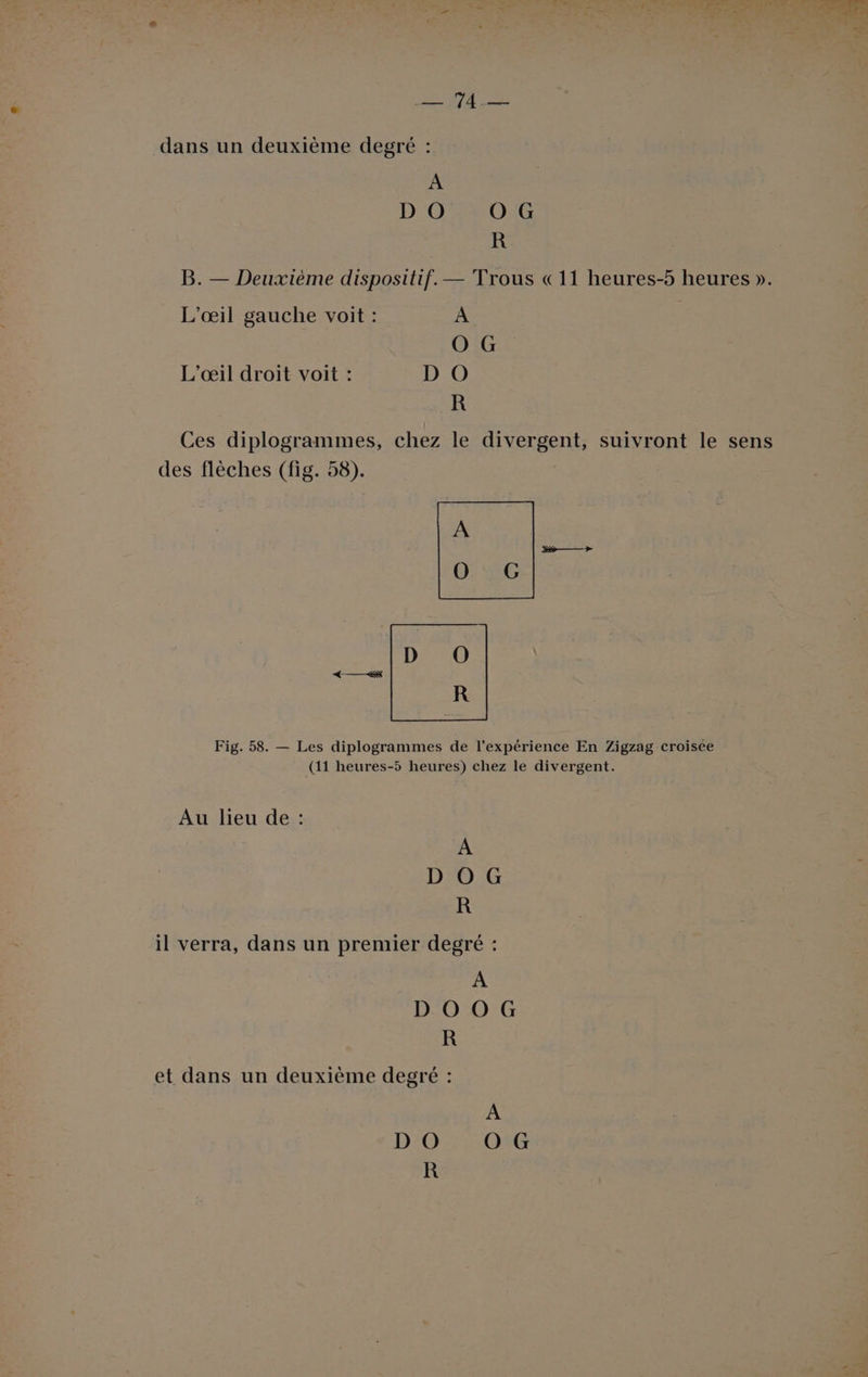 Ro pare dans un deuxième degré : A D O O G R B. — Deuxième dispositif. — Trous «11 heures-5 heures ». L’œil gauche voit : A O G L'œil droit voit : D O R Ces diplogrammes, chez le divergent, suivront le sens des flèches (fig. 58). A O0 G Fig. 58. — Les diplogrammes de l'expérience En Zigzag croisée (11 heures-5 heures) chez le divergent. Au lieu de : A DOG R il verra, dans un premier degré : A DOOG R et dans un deuxième degré :