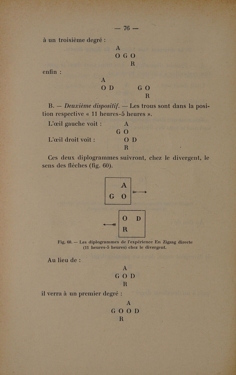 En STE à un troisième degré : A OGO R enfin : À O D G O R B. — Deuxième dispositif. — Les trous sont dans la posi- tion respective € 11 heures-5 heures ». L’œ1l gauche voit : À G O L'œil droit voit : O D R Ces deux diplogrammes suivront, chez le divergent, le sens des flèches (fig. 60). | A G O | ÔO D R Re Fig, 60. — Les diplogrammes de l'expérience En Zigzag directe (11 heures-5 heures) chez le divergent. Au lieu de : G O D R il verra à un premier degré :