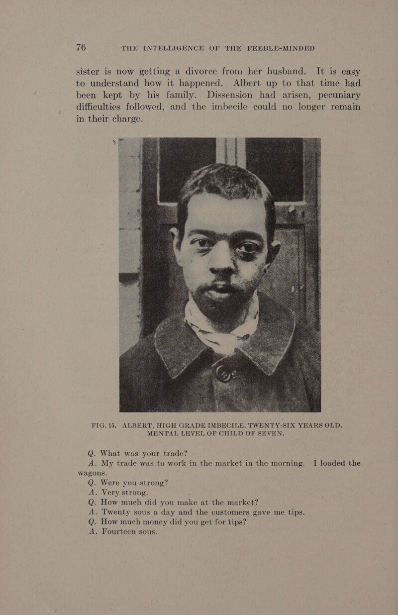 sister is now getting a divorce from her husband. It is easy to understand how it happened. Albert up to that time had been kept by his family. Dissension had arisen, pecuniary difficulties followed, and the imbecile could no longer remain in their charge. FIG. 15. ALBERT, HIGH GRADE IMBECILE, TWENTY-SIX YEARS OLD. MENTAL LEVEL OF CHILD OF SEVEN. Q. What was your trade? A. My trade was to work in the market in the morning. I loaded the wagons. Were you strong? . Very strong. How much did you make at the market? . Twenty sous a day and the customers gave me tips. How much money did you get for tips? . Fourteen sous. &gt;ORORO