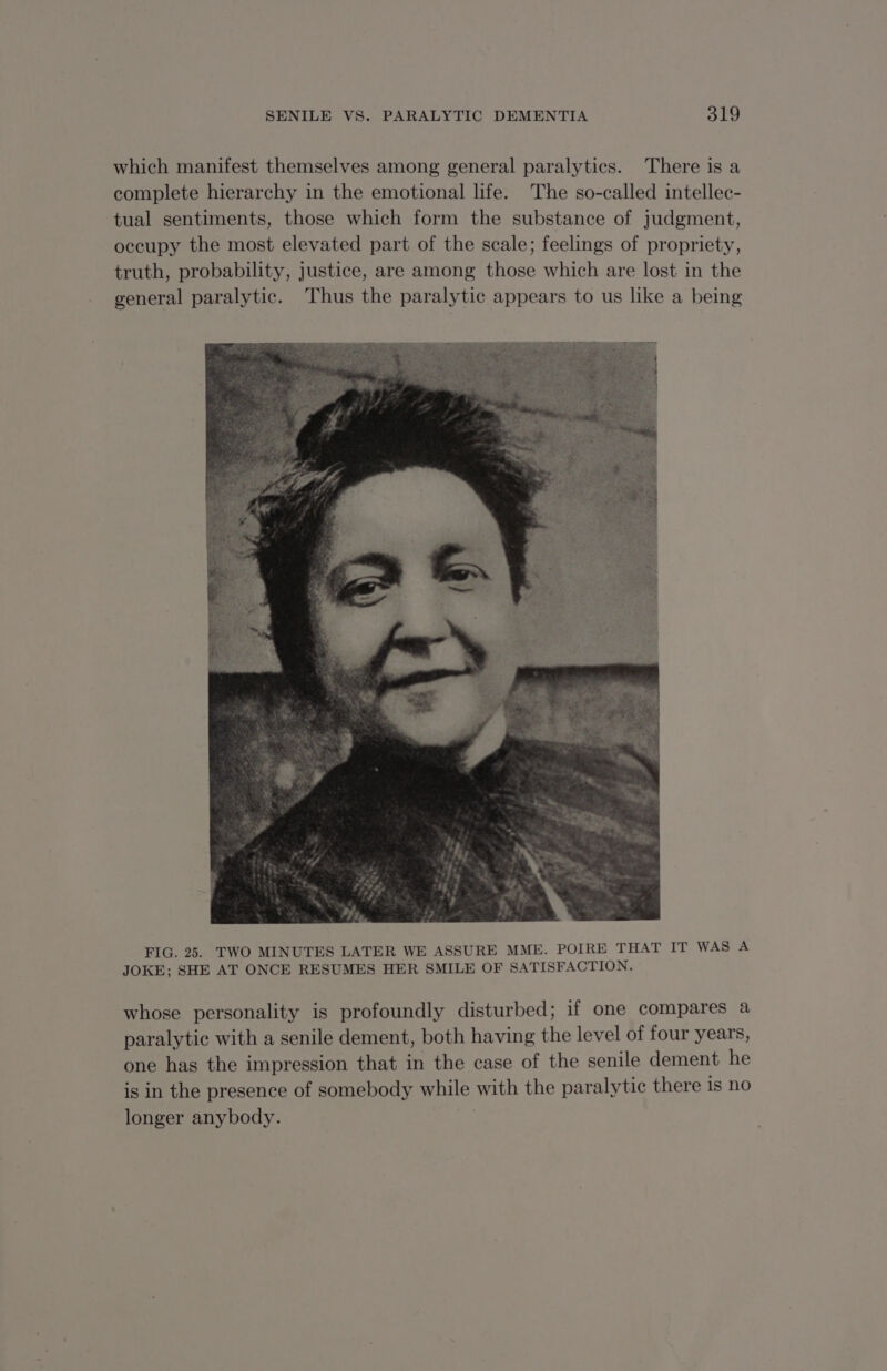 which manifest themselves among general paralytics. There is a complete hierarchy in the emotional life. The so-called intellec- tual sentiments, those which form the substance of judgment, occupy the most elevated part of the scale; feelings of propriety, truth, probability, justice, are among those which are lost in the general paralytic. Thus the paralytic appears to us like a being FIG. 25. TWO MINUTES LATER WE ASSURE MME. POIRE THAT IT WAS A JOKE; SHE AT ONCE RESUMES HER SMILE OF SATISFACTION. whose personality is profoundly disturbed; if one compares a paralytic with a senile dement, both having the level of four years, one has the impression that in the case of the senile dement he is in the presence of somebody while with the paralytic there is no longer anybody.