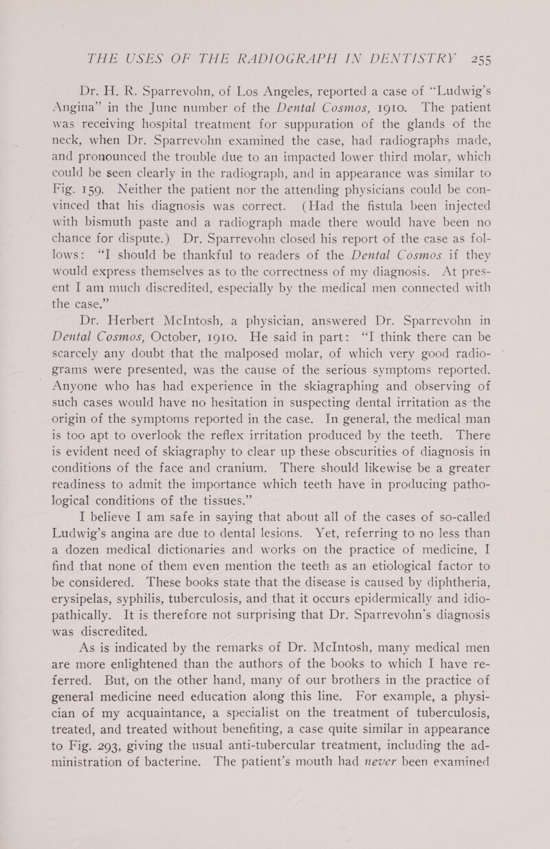 Dr. H. R. Sparrevohn, of Los Angeles, reported a case of “Ludwig’s Angina” in the June number of the Dental Cosmos, 1910. The patient was receiving hospital treatment for suppuration of the glands of the neck, when Dr. Sparrevohn examined the case, had radiographs made, and pronounced the trouble due to an impacted lower third molar, which could be seen clearly in the radiograph, and in appearance was similar to Fig. 159. Neither the patient nor the attending physicians could be con- vinced that his diagnosis was correct. (Had the fistula been injected with bismuth paste and a radiograph made there would have been no chance for dispute.) Dr. Sparrevohn closed his report of the case as fol- lows: “I should be thankful to readers of the Dental Cosmos if they would express themselves as to the correctness of my diagnosis. At pres- ent I am much discredited, especially by the medical men connected with tie case, Dr. Herbert McIntosh, a physician, answered Dr. Sparrevohn in Dental Cosmos, October, 1910. He said in part: “I think there can be scarcely any doubt that the malposed molar, of which very good radio- grams were presented, was the cause of the serious symptoms reported. Anyone who has had experience in the skiagraphing and observing of such cases would have no hesitation in suspecting dental irritation as the origin of the symptoms reported in the case. In general, the medical man is too apt to overlook the reflex irritation produced by the teeth. There is evident need of skiagraphy to clear up these obscurities of diagnosis in conditions of the face and cranium. There should likewise be a greater readiness to admit the importance which teeth have in producing patho- logical conditions of the tissues.” I believe I am safe in saying that about all of the cases of so-called Ludwig’s angina are due to dental lesions. Yet, referring to no less than a dozen medical dictionaries and works on the practice of medicine, I find that none of them even mention the teeth as an etiological factor to be considered. These books state that the disease is caused by diphtheria, erysipelas, syphilis, tuberculosis, and that it occurs epidermically and idio- pathically. It is therefore not surprising that Dr. Sparrevohn’s diagnosis was discredited. As is indicated by the remarks of Dr. McIntosh, many medical men are more enlightened than the authors of the books to which I have re- ferred. But, on the other hand, many of our brothers in the practice of general medicine need education along this line. For example, a physi- cian of my acquaintance, a specialist on the treatment of tuberculosis, treated, and treated without benefiting, a case quite similar in appearance to Fig. 293, giving the usual anti-tubercular treatment, including the ad- ministration of bacterine. The patient's mouth had never been examined