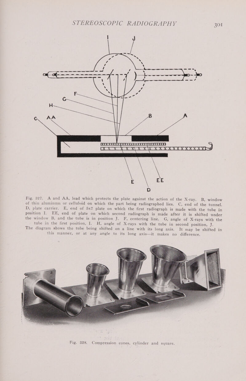 on ESS 0 x x 4 \ Pe \ ae 7) . OF e a co. omy oe og UJ D— -O Ber 4 ry ~— am 4 \ EERE SEREEAA I DG G'S B1@ DNS SO 2.2.6.2 OO EO.8'8 ty)! Fig. 327. A and AA, lead which protects the plate against the action of the X-ray. B, window of thin aluminum or celluloid on which the part being radiographed lies. C, end of the tunnel. D, plate carrier. E, end of 5x7 plate on which the first radiograph is made with the tube in position I. EE, end of plate on which second radiograph is made after it is shifted under the window B, and the tube is in position J. F, centering line. G, angle of X-rays with the tube in the first position, I. H, angle of X-rays with the tube in-second position, J. The diagram shows the tube being shifted on a line with its long axis. It may be shifted in this manner, or at any angle to its long axis—it makes no difference.