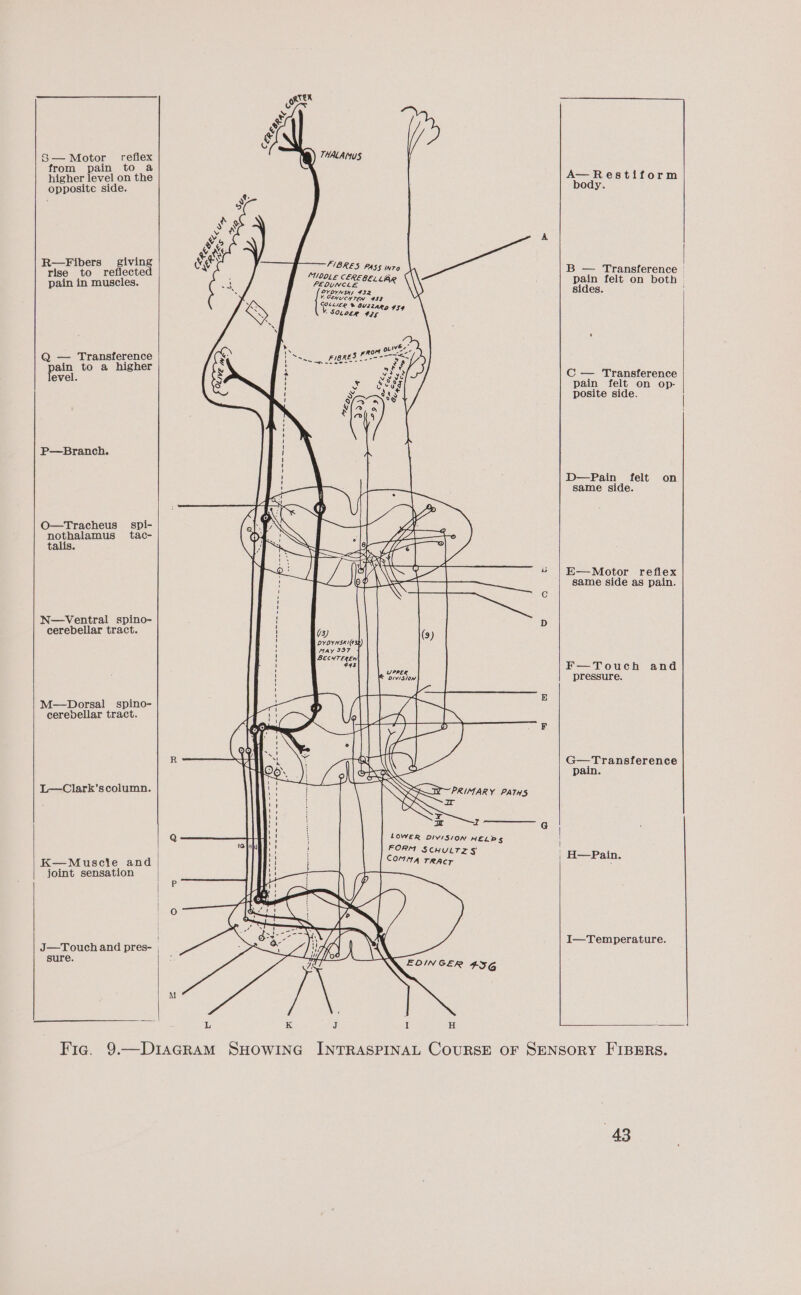 S— Motor reflex from pain to @ higher level on the opposite side. R—Fibers giving rise to reflected pain in muscles. Q — Transference pain to a higher level. P—Branch. O—Tracheus spi- nothalamus tac- talis N—Ventral spino- cerebellar tract. M—Dorsal spino- cerevellar tract. L—Clark’scolumn. K—Muscie and joint sensation J—Touch and pres- sure. TEUUT Ge M TER &amp; Z v $ &amp; § 8) THALAMUS FIBRES PAS$ iro SOLE CERE, A, PEDUNCLE oe an \ OYOYNSys 432 Y CENUCYTEN 439 Taras * SViz24R Dg 959 ' SOL OLR FIGS » ive, Ny Rom 9 ates iF VSS. FiBRES FR RS SS ‘ See ike ¥ A vey § H weer S H vo deddg , Nj ’ ai PRIMARY PATHS Ir I LOWER DIVISION HELP Ky FORM SCHULTZS Comma rRAcr EDINGER 4.356 L K J : os | | B — Transference | pain felt on both | sides. C — Transference pain felt on op- posite side. | D—Pain felt on same side. E—Motor reflex same side as pain. F—Touch and pressure. G—Transference pain. H—Pain. I—Temperature.