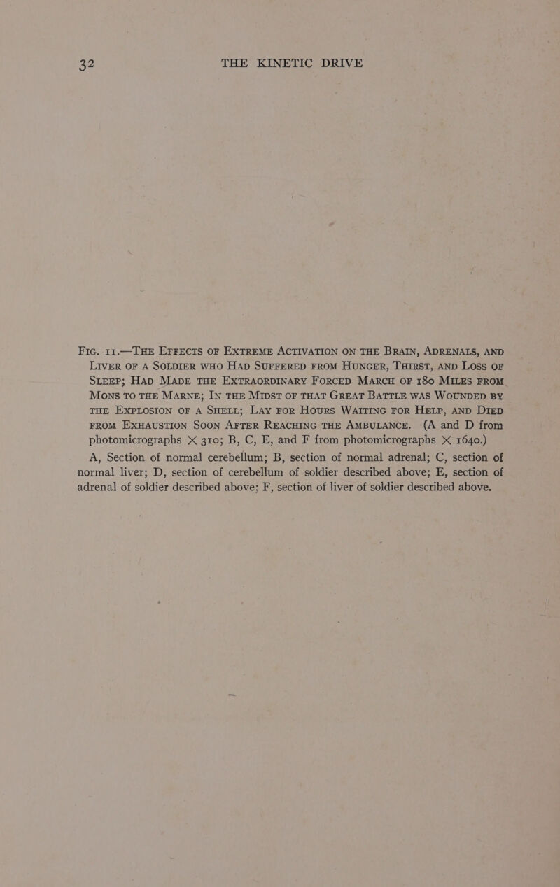 Fic. 11.—THE EFFECTS OF EXTREME ACTIVATION ON THE BRAIN, ADRENALS, AND LIVER OF A SOLDIER WHO HAD SUFFERED FROM HUNGER, THIRST, AND LOSS OF SLEEP; Hap MADE THE EXTRAORDINARY ForRCED MARCH OF 180 MILES FROM MONS TO THE MARNE; IN THE MIDST OF THAT GREAT BATTLE WAS WOUNDED BY THE EXPLOSION OF A SHELL; LAY FOR Hours WAITING FOR HELP, AND DIED FROM EXHAUSTION SOON AFTER REACHING THE AMBULANCE. (A and D from photomicrographs X 310; B, C, E, and F from photomicrographs X 1640.) A, Section of normal cerebellum; B, section of normal adrenal; C, section of normal liver; D, section of cerebellum of soldier described above; E, section of adrenal of soldier described above; F, section of liver of soldier described above.