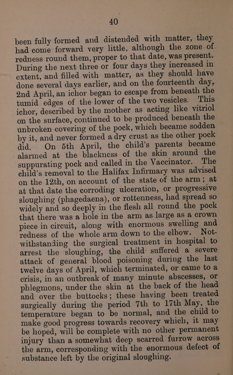 been fully formed and distended with matter, they had come forward very little, although the zone of. redness round them, proper to that date, was present. During the next three or four days they increased in extent, and filled with matter, as they should have done several days earlier, and on the fourteenth day, 2nd April, an ichor began to escape from beneath the tumid edges of the lower of the two vesicles. This ichor, described by the mother as acting like vitriol on the surface, continued to be produced beneath the unbroken covering of the pock, which became sodden by it, and never formed a dry crust as the other pock did. On 5th April, the child’s parents became alarmed at the blackness of the skin around the suppurating pock and called in the Vaccinator. The child’s removal to the Halifax Infirmary was advised on the 12th, on account of the state of the arm ; at at that date the corroding ulceration, or progressive sloughing (phagedaena), or rottenness, had spread so widely and so deeply in the flesh all round the pock that there was a hole in the arm as large as a crown piece in circuit, along with enormous swelling and redness of the whole arm down to the elbow. Not- withstanding the surgical treatment in hospital to arrest the ‘sloughing, the child suffered a severe attack of general blood poisoning during the last twelve days of April, which terminated, or came to a crisis, in an outbreak of many minute abscesses, or phlegmons, under the skin at the back of the head and over the buttocks; these having been treated surgically during the period 7th to 17th May, the temperature began to be normal, and the child to make good progress towards recovery which, it may be hoped, will be complete with no other permanent injury than a somewhat deep scarred furrow across the arm, corresponding with the enormous defect of substance left by the original sloughing.