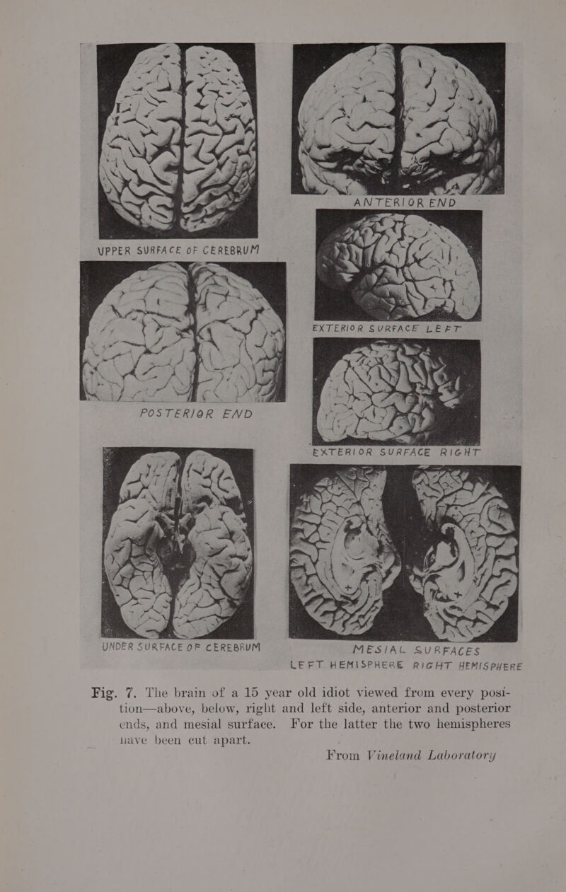 “ANTERIOR END i iy i. &gt; ‘e ‘ 6 ; EXTERIOR SURFACE LEFT pitts, res POSTERIOR END RFACE RIGHT EOF CEREBRUM MESIAL SURFACES LEFT HEMISPHERE RIGHT HEMISPHERE UNDER SURFAC Fig. 7. The brain of a 15 year old idiot viewed from every posi- tion—above, below, right and left side, anterior and posterior ends, and mesial surface. For the latter the two hemispheres liave been cut apart. From Vineland Laboratory