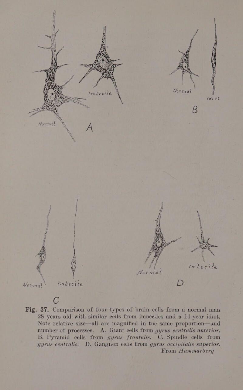 Norma (dior f i Novmet imbecile {2 C Fig. 37. Comparison of four types of brain cells from a normal man 28 years old with similar ceils from imbec.les and a 14-year idiot. Note relative size—ali are magnified in the same proportion—and number of processes. A. Giant cells from gyrus centralis anterior. B. Pyramid cells from gyrus frontalis. C. Spindle cells trom gyrus centralis. D. Gangnhon celis from gyrus occipitalis superior. From /lammarberg