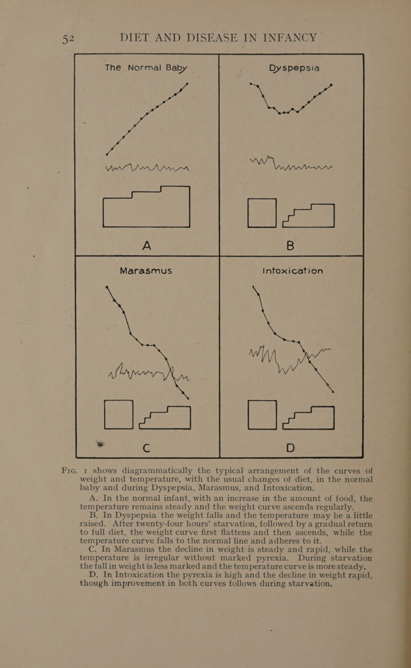 Marasmus weight and temperature, with the usual changes of diet, in the normal baby and during Dyspepsia, Marasmus, and Intoxication. A. In the normal infant, with an increase in the amount of food, the temperature remains steady and the weight curve ascends regularly. B. In Dyspepsia the weight falls and the temperature may be a little raised. After twenty-four hours’ starvation, followed by a gradual return to full diet, the weight curve first flattens and then ascends, while the temperature curve falls to the normal line and adheres to it. C. In Marasmus the decline in weight is steady and rapid, while the temperature is irregular without marked pyrexia. During starvation the fallin weight is less marked and the temperature curve is more steady. D. In Intoxication the pyrexia is high and the decline in weight rapid, though improvement in both curves follows during starvation,