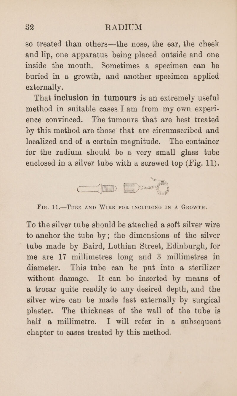 so treated than others—the nose, the ear, the cheek and lip, one apparatus being placed outside and one inside the mouth. Sometimes a specimen can be buried in a growth, and another specimen applied externally. That inclusion in tumours is an extremely useful method in suitable cases 1am from my own experi- ence convinced. The tumours that are best treated by this method are those that are circumscribed and localized and of a certain magnitude. The container for the radium should be a very small glass tube enclosed in a silver tube with a screwed top (Fig. 11). ues a (ZS Fig. 11.—TusE AND WIRE FOR INCLUDING IN A GROWTH. To the silver tube should be attached a soft silver wire to anchor the tube by; the dimensions of the silver tube made by Baird, Lothian Street, Edinburgh, for me are 17 millimetres long and 3 millimetres in diameter. This tube can be put into a sterilizer without damage. It can be inserted by means of a trocar quite readily to any desired depth, and the silver wire can be made fast externally by surgical plaster. The thickness of the wall of the tube is half a millimetre. I will refer in a subsequent chapter to cases treated by this method.