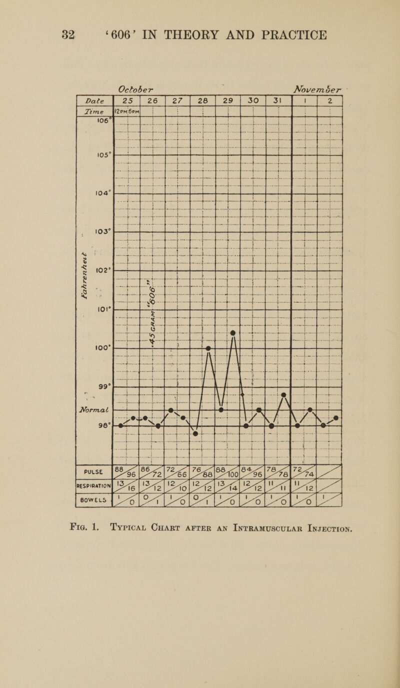 October November a eae ee ee | Sen ecm om i Peemne ool theives ele rece Fahrenhect eee i Conia  Fie. 1. Typrcan CHART AFTER AN INTRAMUSCULAR INJECTION.