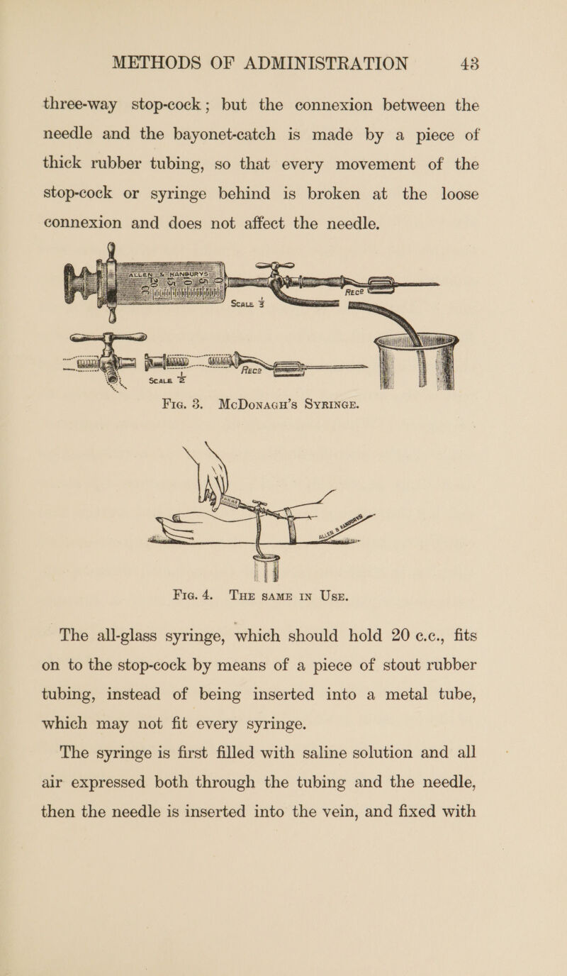 three-way stop-cock; but the connexion between the needle and the bayonet-catch is made by a piece of thick rubber tubing, so that every movement of the stop-cock or syringe behind is broken at the loose connexion and does not affect the needle.   The all-glass syringe, which should hold 20 c.c., fits on to the stop-cock by means of a piece of stout rubber tubing, instead of being inserted into a metal tube, which may not fit every syringe. The syringe is first filled with saline solution and all air expressed both through the tubing and the needle, then the needle is inserted into the vein, and fixed with
