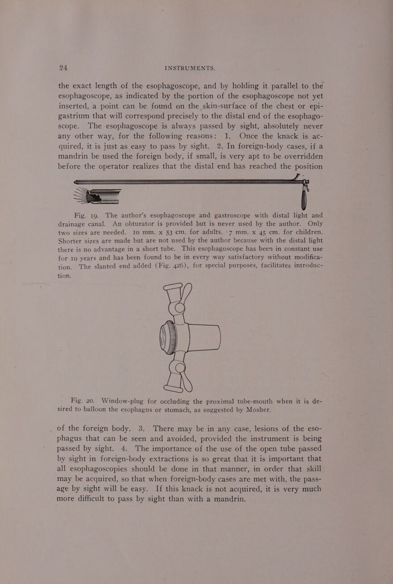 the exact length of the esophagoscope, and by holding it parallel to the esophagoscope, as indicated by the portion of the esophagoscope not yet inserted, a point can be found on the skin-surface of the chest or epi- gastrium that will correspond precisely to the distal end of the esophago- scope. ‘The esophagoscope is always passed by sight, absolutely never any other way, for the following reasons: 1. Once the knack is ac- quired, it is just as easy to pass by sight. 2. In foreign-body cases, if a mandrin be used the foreign body, if small, is very apt to be overridden before the operator realizes that the distal end has reached the position Fig. 19. The author’s esophagoscope and gastroscope with distal light and drainage canal. An obturator is provided but is never used by the author. Only two sizes are needed. Io mm. x 53 cm. for adults. »7 mm. x 45 cm. for children. Shorter sizes are made but are not used by the author because with the distal light there is no advantage in a short tube. This esophagoscope has been in constant use for 10 years and has been found to be in every way satisfactory without modifica- tion. The slanted end added (Fig. 426), for special purposes, facilitates introduc- tion. Fig. 20. Window-plug for occluding the proximal tube-mouth when it is de- sired to balloon the esophagus or stomach, as suggested by Mosher. of the foreign body. 3. There may be in any case, lesions of the eso- phagus that can be seen and avoided, provided the instrument is being passed by sight. 4. The importance of the use of the open tube passed by sight in foreign-body extractions is so great that it is important that all esophagoscopies should be done in that manner, in order that skill may be acquired, so that when foreign-body cases are met with, the pass- age by sight will be easy. If this knack is not acquired, it is very much more difficult to pass by sight than with a mandrin.