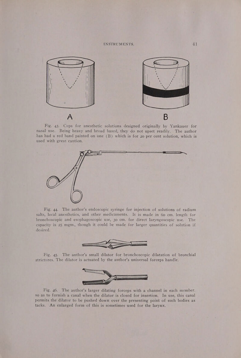 B Fig. 43. Cups for anesthetic solutions designed originally by Yankauer for nasal use. Being heavy and broad based, they do not upset readily. The author has had a red band painted on one (B) which is for 20 per cent solution, which is used with great caution. Fig. 44. The author’s endoscopic syringe for injection of solutions of radium salts, local anesthetics, and other medicaments. It is made in 60 cm. length for bronchoscopic and esophagoscopic use, 30 cm. for direct laryngoscopic use. The capacity is 25 mem., though it could be made for larger quantities of solution if desired. Fig. 45. The author’s small dilator for bronchoscopic dilatation of bronchial strictures. The dilator is actuated by the author’s universal forceps handle. Fig. 46. The author’s larger dilating forceps with a channel in each member. so as to furnish a canal when the dilator is closed for insertion, In use, this canal permits the dilator to be pushed down over the presenting point of such bodies as tacks. An enlarged form of this is sometimes used for the larynx.