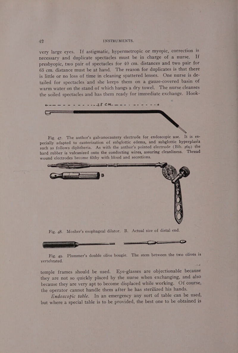 very large eyes. If astigmatic, hypermetropic or myopic, correction is necessary and duplicate spectacles must be in charge of a nurse. li presbyopic, two pair of spectacles for 40 cm. distances and two pair for 65 em. distance must be at hand. The reason for duplicates is that there is little or no loss of time in cleaning spattered lenses. One nurse is de- tailed for spectacles and she keeps them on a gauze-covered basin of warm water on the stand of which hangs a dry towel. The nurse cleanses the soiled spectacles and has them ready for immediate exchange. Hook- So eee Fees it re IS Fig. 47. The author’s galvanocautery electrode for endoscopic use. It is es- pecially adapted to cauterization of subglottic edema, and subglottic hyperplasia such as follows diphtheria. As with the author’s pointed electrode (Bib. 269) the hard rubber is vulcanized onto the conducting wires, assuring cleanliness. Thread wound electrodes become filthy with blood and secretions. Fig. 49. Plummer’s double olive bougie. The stem between the two olives is vertebrated. temple frames should be used. Eye-glasses are objectionable because they are not so quickly placed by the nurse when exchanging, and also because they are very apt to become displaced while working. Of course, the operator cannot handle them after he has sterilized his hands, Endoscopic table. In an emergency any sort of table can be used, but where a special table is to be provided, the best one to be obtained is