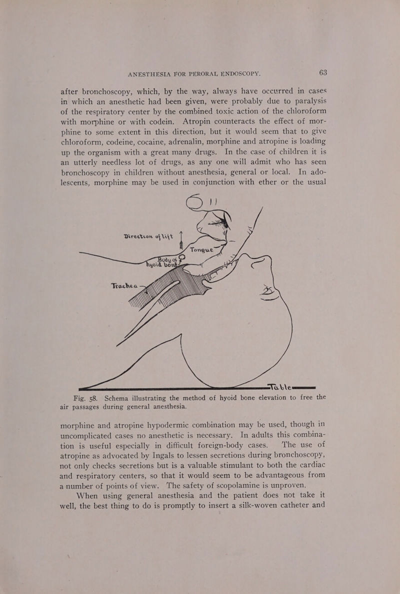 after bronchoscopy, which, by the way, always have occurred in cases in which an anesthetic had been given, were probably due to paralysis of the respiratory center by the combined toxic action of the chloroform with morphine or with codein. Atropin counteracts the effect of mor- phine to some extent in this direction, but it would seem that to give chloroform, codeine, cocaine, adrenalin, morphine and atropine is loading up the organism with a great many drugs. In the case of children it is an utterly needless lot of drugs, as any one will admit who has seen bronchoscopy in children without anesthesia, general or local. In ado- lescents, morphine may be used in conjunction with ether or the usual ee em Fig. 58. Schema illustrating the method of hyoid bone elevation to free the air passages during general anesthesia. morphine and atropine hypodermic combination may be used, though in uncomplicated cases no anesthetic is necessary. In adults this combina- tion is useful especially in difficult foreign-body cases. The use of atropine as advocated by Ingals to lessen secretions during bronchoscopy, not only checks secretions but is a valuable stimulant to both the cardiac and respiratory centers, so that it would seem to be advantageous from a number of points of view. The safety of scopolamine is unproven. When using general anesthesia and the patient does not take it well, the best thing to do is promptly to insert a silk-woven catheter and