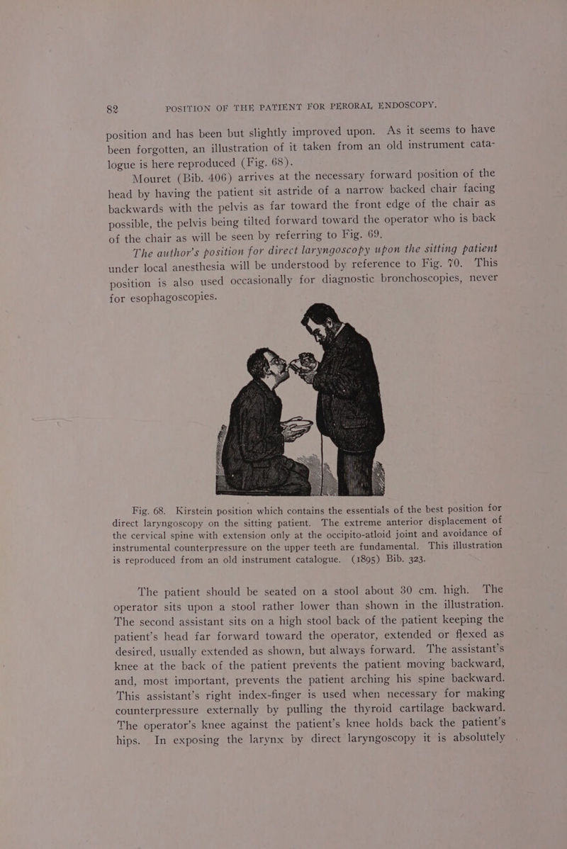 position and has been but slightly improved upon. As it seems to have been forgotten, an illustration of it taken from an old instrument cata- logue is here reproduced (Fig. 68). Mouret (Bib. 406) arrives at the necessary forward position of the head by having the patient sit astride of a narrow backed chair facing backwards with the pelvis as far toward the front edge of the chair as possible, the pelvis being tilted forward toward the operator who is back of the chair as will be seen by referring to Fig. 69. The author’s position for direct laryngoscopy upon the sitting patient under local anesthesia will be understood by reference to Fig. 70. This position is also used occasionally for diagnostic bronchoscopies, never for esophagoscopies. Fig. 68. Kirstein position which contains the essentials of the best position for direct laryngoscopy on the sitting patient. The extreme anterior displacement of the cervical spine with extension only at the occipito-atloid joint and avoidance of instrumental counterpressure on the upper teeth are fundamental. This illustration is reproduced from an old instrument catalogue. (1895) Bib. 323. The patient should be seated on a stool about 30 cm. high. The operator sits upon a stool rather lower than shown in the illustration. The second assistant sits on a high stool back of the patient keeping the patient’s head far forward toward the operator, extended or flexed as desired, usually extended as shown, but always forward. The assistant’s knee at the back of the patient prevents the patient moving backward, and, most important, prevents the patient arching his spine backward. This assistant’s right index-finger is used when necessary for making counterpressure externally by pulling the thyroid cartilage backward. The operator’s knee against the patient’s knee holds back the patient’s hips. In exposing the larynx by direct laryngoscopy it is absolutely