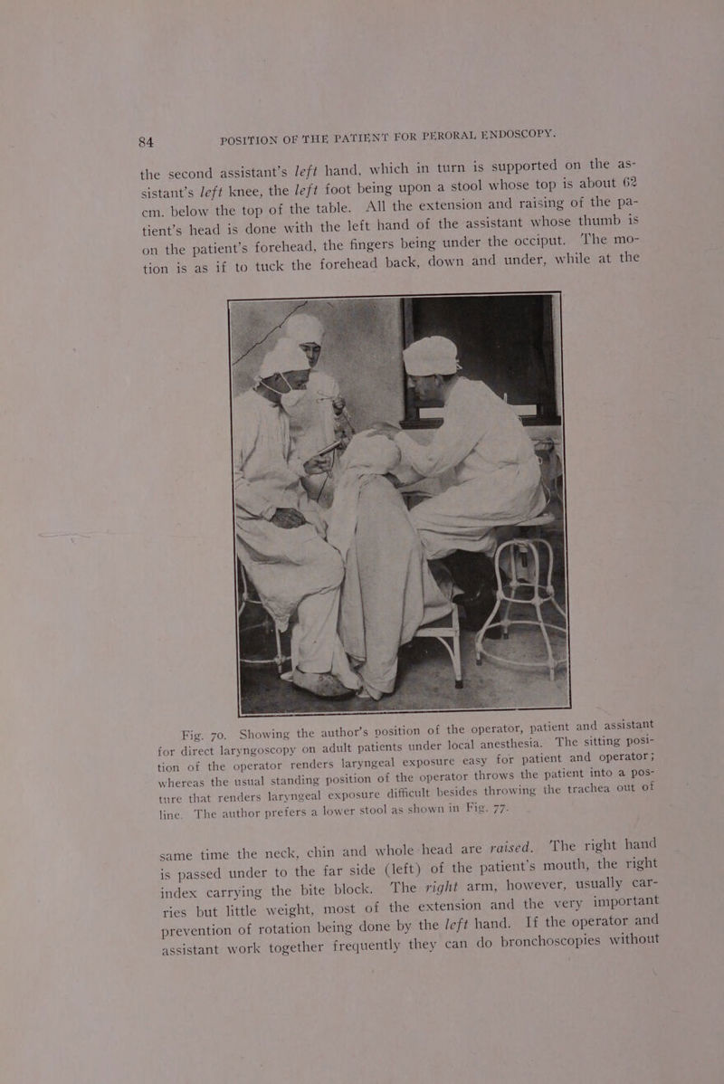 the second assistant’s Jeft hand, which in turn is supported on the as- sistant’s left knee, the Jeft foot being upon a stool whose top is about 62 cm. below the top of the table. All the extension and raising of the pa- tient’s head is done with the left hand of the assistant whose thumb is on the patient’s forehead, the fingers being under the occiput. The mo- tion is as if to tuck the forehead back, down and under, while at the Fig. 70. Showing the author’s position of the operator, patient and assistant for direct laryngoscopy on adult patients under local anesthesia. The sitting posi- tion of the operator renders laryngeal exposure easy for patient and operator, whereas the usual standing position of the operator throws the patient into a pos- ture that renders laryngeal exposure difficult besides throwing the trachea out of line. The author prefers a lower stool as shown in Fig. 77. same time the neck, chin and whole head are raised, The right hand is passed under to the far side (left) of the patient's mouth, the right index carrying the bite block. The right arm, however, usually car- ries but little weight, most of the extension and the very important prevention of rotation being done by the left hand. If the operator and assistant work together frequently they can do bronchoscopies without