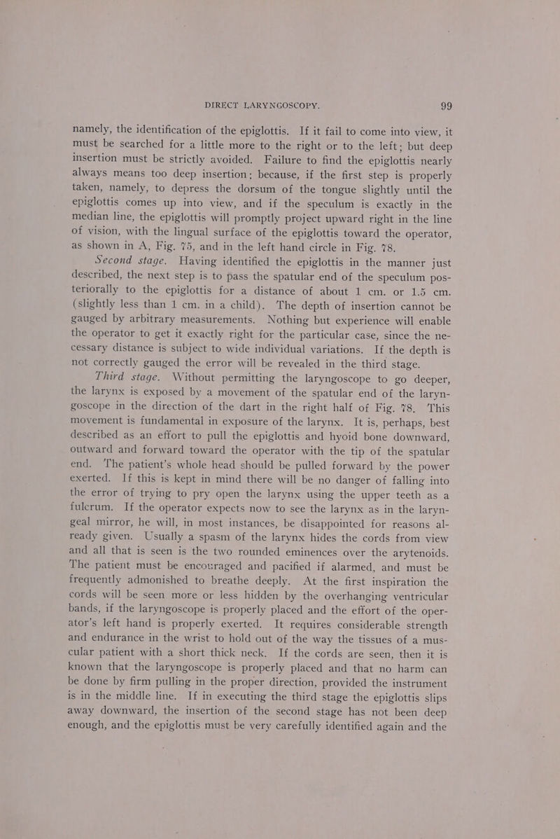 namely, the identification of the epiglottis. If it fail to come into view, it must be searched for a little more to the right or to the lela buts deep insertion must be strictly avoided. Failure to find the epiglottis nearly always means too deep insertion: because, if the first step is properly taken, namely, to depress the dorsum of the tongue slightly until the epiglottis comes up into view, and if the speculum is exactly in the median line, the epiglottis will promptly project upward right in the line of vision, with the lingual surface of the epiglottis toward the operator, as shown in A, Fig. 75, and in the left hand circle in Fig. 78. Second stage. Having identified the epiglottis in the manner just described, the next step is to pass the spatular end of the speculum pos- teriorally to the epiglottis for a distance of about 1 cm. or 1.5 cm. (slightly less than 1 cm. in a child). The depth of insertion cannot be gauged by arbitrary measurements. Nothing but experience will enable the operator to get it exactly right for the particular case, since the ne- cessary distance is subject to wide individual variations. If the depth is not correctly gauged the error will be revealed in the third stage. Third stage. Without permitting the laryngoscope to go deeper, the larynx is exposed by a movement of the spatular end of the laryn- goscope in the direction of the dart in the right half of Fig. 78. his movement is fundamental in exposure of the larynx, It is, perhaps, best described as an effort to pull the epiglottis and hyoid bone downward, outward and forward toward the operator with the tip of the spatular end. The patient’s whole head should be pulled forward by the power exerted. If this is kept in mind there will be no danger of falling into the error of trying to pry open the larynx using the upper teeth as a fulcrum. If the operator expects now to see the larynx as in the laryn- geal mirror, he will, in most instances, be disappointed for reasons al- ready given. Usually a spasm of the larynx hides the cords from view and all that is seen is the two rounded eminences over the arytenoids. The patient must be encouraged and pacified if alarmed, and must be frequently admonished to breathe deeply. At the first inspiration the cords will be seen more or less hidden by the overhanging ventricular bands, if the laryngoscope is properly placed and the effort of the oper- ator’s left hand is properly exerted. It requires considerable strength and endurance in the wrist to hold out of the way the tissues of a mus- cular patient with a short thick neck. If the cords are seen, then it is known that the laryngoscope is properly placed and that no harm can be done by firm pulling in the proper direction, provided the instrument is in the middle line. If in executing the third stage the epiglottis slips away downward, the insertion of the second stage has not been deep enough, and the epiglottis must be very carefully identified again and the