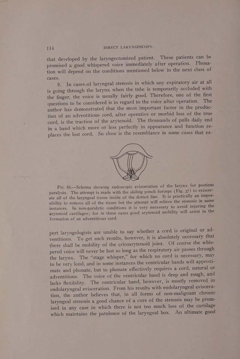 that developed by the laryngectomized patient. These patients can be promised a good whispered voice immediately after operation. Phona- tion will depend on the conditions mentioned below in the next class of cases. 9. In cases.of laryngeal stenosis in which any expiratory eh recnmne Ul is going through the larynx when the tube is temporarily occluded with the finger, the voice is usually fairly good. Therefore, one of the first questions to be considered is in regard to the voice after operation. The author has demonstrated that the most important factor in the produc- tion of an adventitious cord, after operative or morbid loss of the true cord, is the traction of the arytenoid. The thousands of pulls daily end in a band which more or less perfectly in appearance and function re- places the lost cord. So close is the resemblance in some cases that ex- Fic. 86—Schema showing endoscopic evisceration of the larynx for posticus paralysis. The attempt is made with the sliding punch forceps (Fig. 37) to eviscer- ate all of the laryngeal tissue inside of the dotted line. It is practically an impos- sibility to remove all of the tissue but the attempt will relieve the stenosis in some instances. In non-paralytic conditions it is very necessary to avoid injuring the arytenoid cartilages; for in these cases good arytenoid mobility will assist in the formation of an adventitious cord. pert laryngologists are unable to say whether a cord is original or ad- ventitious. ‘To get such results, however, it is absolutely necessary that there shall be mobility of the cricoarytenoid joint. Of course the whis- pered voice will never be lost so long as the respiratory air passes through the larynx. The “stage whisper,” for which no cord is necessary, may to be very loud, and in some instances the ventricular bands will approx1- mate and phonate, but to phonate effectively requires a cord, natural or adventitious. ‘The voice of the ventricular band is deep and rough, and lacks flexibility. ‘The ventricular band, however, is mostly removed in endolaryngeal evisceration. From his results with endolaryngeal eviscera- tion, the author believes that, in all forms of non-malignant chronic laryngeal stenosis a good chance of a cure of the stenosis may be prom- ised in any case in which there is not too much loss of the cartilage which maintains the patulence of the laryngeal box. An ultimate good