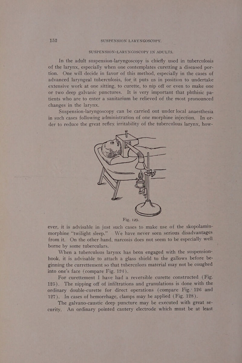 SUSPENSION-LARYNGOSCOPY IN ADULTS. In the adult suspension-laryngoscopy is chiefly used in tuberculosis of the larynx, especially when one contemplates curetting a diseased por- tion. One will decide in favor of this method, especially in the cases of advanced laryngeal tuberculosis, for it puts us in position to undertake extensive work at one sitting, to curette, to nip off or even to make one or two deep galvanic punctures. It is very important that phthisic pa- tients who are to enter a sanitarium be relieved of the most pronounced changes in the larynx. Suspension-laryngoscopy can be carried out under local anaesthesia in such cases following administration of one morphine injection. In or- der to reduce the great reflex irritability of the tuberculous larynx, how- ever, it is advisable in just such cases to make use of the skopolamin- morphine “twilight sleep.” We have never seen serious disadvantages from it. On the other hand, narcosis does not seem to be especially well borne by some tuberculars. When a tuberculous larynx has been engaged with the suspension- hook, it is advisable to attach a glass shield to the gallows before be- ginning the currettement so that tuberculous material may not be coughed into one’s face (compare Fig. 124). For curettement I have had a reversible curette constructed (Fig. 125). The nipping off of infiltrations and granulations is done with the ordinary double-curette for direct operations (compare Fig.’ 126 and 127). In cases of hemorrhage, clamps may be applied (Fig. 128). The galvano-caustic deep puncture may be executed with great se- curity. An ordinary pointed cautery electrode which must be at least