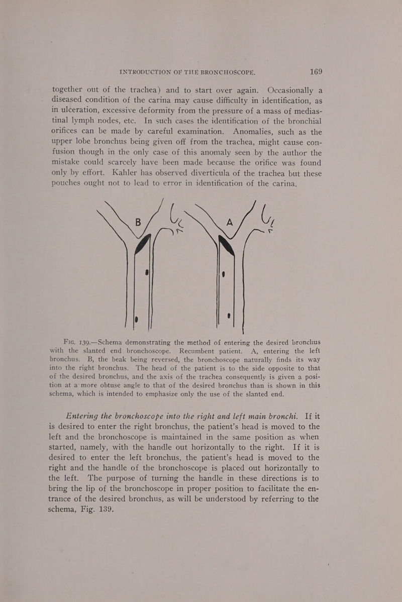 together out of the trachea) and to start over again. Occasionally a diseased condition of the carina may cause difficulty in identification, as in ulceration, excessive deformity from the pressure of a mass of medias- tinal lymph nodes, etc. In such cases the identification of the bronchial orifices can be made by careful examination. Anomalies, such as the upper lobe bronchus being given off from the trachea, might cause con- fusion though in the only case of this anomaly seen by the author the mistake could scarcely have been made because the orifice was found only by effort. Kahler has observed diverticula of the trachea but these pouches ought not to lead to error in identification of the carina. NU AON Fic. 139.—Schema demonstrating the method of entering the desired bronchus with the slanted end bronchoscope. Recumbent patient. A, entering the left bronchus. B, the beak being reversed, the bronchoscope naturally finds its way into the right bronchus. The head of the patient is to the side opposite to that of the desired bronchus, and the axis of the trachea consequently is given a posi- tion at a more obtuse angle to that of the desired bronchus than is shown in this schema, which is intended to emphasize only the use of the slanted end. Entering the bronchoscope into the right and left main bronchi. If it is desired to enter the right bronchus, the patient’s head is moved to the left and the bronchoscope is maintained in the same position as when started, namely, with the handle out horizontally to the right. If it is desired to enter the left bronchus, the patient’s head is moved to the right and the handle of the bronchoscope is placed out horizontally to the left. ‘The purpose of turning the handle in these directions is to bring the lip of the bronchoscope in proper position to facilitate the en- trance of the desired bronchus, as will be understood by referring to the schema, Fig. 139.