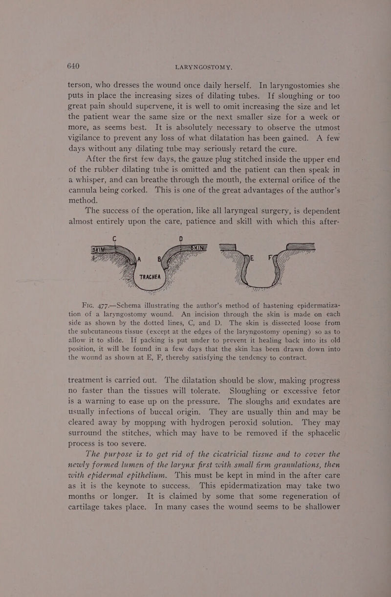 terson, who dresses the wound once daily herself. In laryngostomies she puts in place the increasing sizes of dilating tubes. If sloughing or too great pain should supervene, it is well to omit increasing the size and let the patient wear the same size or the next smaller size for a week or more, as seems best. It is absolutely necessary to observe the utmost vigilance to prevent any loss of what dilatation has been gained. A few days without any dilating tube may seriously retard the cure. After the first few days, the gauze plug stitched inside the upper end of the rubber dilating tube is omitted and the patient can then speak in a whisper, and can breathe through the mouth, the external orifice of the cannula being corked. This is one of the great advantages of the author’s method. The success of the operation, like all laryngeal surgery, is dependent almost entirely upon the care, patience and skill with which this after- Fic. 477.—Schema illustrating the author’s method of hastening epidermatiza- tion of a laryngostomy wound. An incision through the skin is made on each side as shown by the dotted lines, C, and D. The skin is dissected loose from the subcutaneous tissue (except at the edges of the laryngostomy opening) so as to allow it to slide. If packing is put under to prevent it healing back into its old position, it will be found in a few days that the skin has been drawn down into the wound as shown at E, F, thereby satisfying the tendency to contract. treatment is carried out. ‘The dilatation should be slow, making progress no faster than the tissues will tolerate. Sloughing or excessive fetor is a warning to ease up on the pressure. The sloughs and exudates are usually infections of buccal origin. They are usually thin and may be cleared away by mopping with hydrogen peroxid solution. They may surround the stitches, which may have to be removed if the sphacelic process is too severe. The purpose is to get rid of the cicatricial tissue and to cover the newly formed lumen of the larynx first with small firm granulations, then with epidermal epithelium. ‘This must be kept in mind in the after care as it is the keynote to success. This epidermatization may take two months or longer. It is claimed by some that some regeneration of cartilage takes place. In many cases the wound seems to be shallower