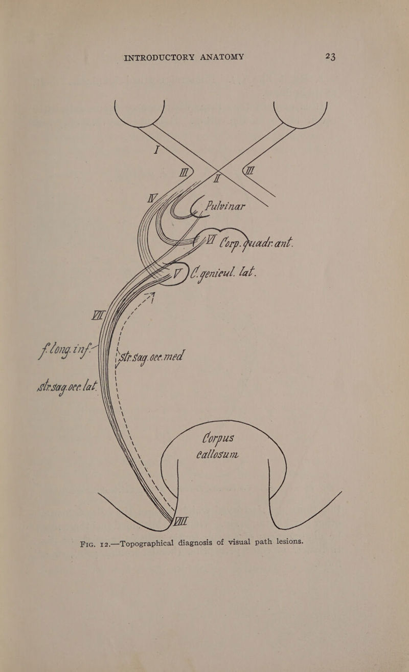 fe long, tif: strsag OC lat. ? Tr say gee. med \ \ \ \ Corpus Callosium Fic. 12.—Topographical diagnosis of visual path lesions.