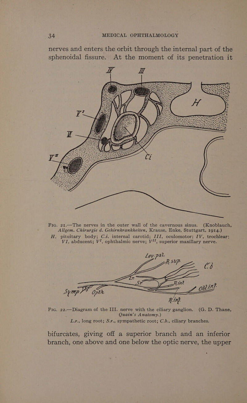 nerves and enters the orbit through the internal part of the sphenoidal fissure. At the moment of its penetration it Fic. 21.—The nerves in the outer wall of the cavernous sinus. (Knoblauch, Allgem. Chirurgie d. Gehirnkrankheiten, Krause, Enke, Stuttgart, 1914.) H, pituitary body; C.i, internal carotid; ZZI, oculomotor; IV, trochlear; VI, abducent; V/, ophthalmic nerve; V”, superior maxillary nerve. Symp } Opeh L.r., long root; S.r., sympathetic root; C.b., ciliary branches. bifurcates, giving off a superior branch and an inferior branch, one above and one below the optic nerve, the upper .