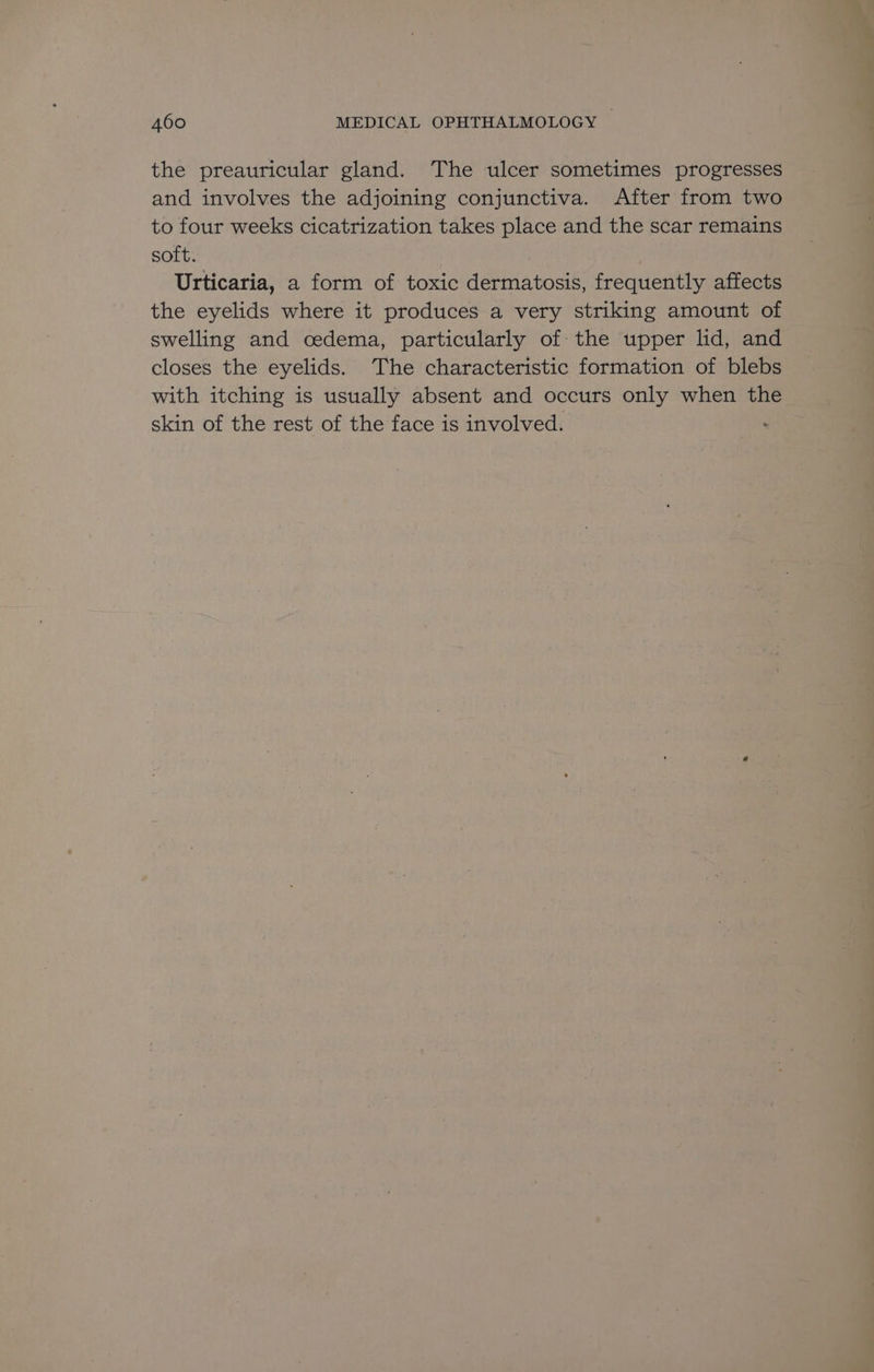 the preauricular gland. The ulcer sometimes progresses and involves the adjoining conjunctiva. After from two to four weeks cicatrization takes place and the scar remains soft. Urticaria, a form of toxic dermatosis, frequently affects the eyelids where it produces a very striking amount of swelling and cedema, particularly of the upper lid, and closes the eyelids. The characteristic formation of blebs with itching is usually absent and occurs only when the skin of the rest of the face is involved.