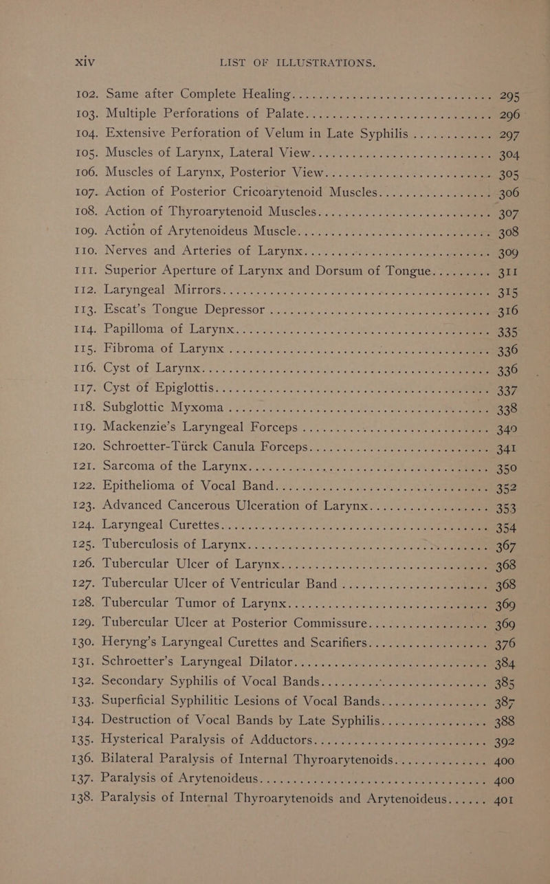 . wane. aiter Gompletesticalnior pean ean kee a, 295 . MultiplePerforations*ot Palateswis a. .0 ee Jess 296 . Extensive Perforation of Velumun Late Syphilis... ...6:eeeeee 207 - Muscles of Larynx, Lateral Viewse4 vane 8 2) ee 304 . Muscles of Larynx, Posterior Views>.2.02a.2 4.0 .-< 305 « Action of Posterior Cricoarytenoid: Musclés. . 25.24). eee 306 . Action of Thyroarytenoid’ Muscles... +... me ese) 307 . Action of Arytenoideus Muscle... 2, (vr....0, 19. 308 » Nerves and Arteries sofelaryaneece ..04 WA Ola eed er 309 . Superior Aperture of Larynx and Dorsum of Tongue......... 311 . Laryngeal Mirrors 27.8) gare)... nN Od nee 315 . Escat’s. Tongue Depressor iinct) evi son eon el 316 . Papilloma sof Larynx. Pe Na. A sae ee Oe eee 335 ssFibtomalot“etyti xa eerie era er ees ens a 2 336 : Cyst: of Larynx? ic Fen ea ole wlan tating een e CRs taal ae 336 . Cyst Ot “Epi glottis. s Poi hee jana: Hea sae 2a Oe 337 . Subglottic Myxoma i cap ees ee Oe ee .. 338 . Mackenzie's Laryngeal-Forceps’. 0.0.00 50. 2a ae 340 : echroetter- Turck Cantula Borceps. 200)... iene 341 . warcomaof the! Larynx 24 ee tae 350 . Epithelioma of Vocal) Bandi aes aee sche.) a 352 . Advanced Cancerous Ulceration of Larynx. 0.0)... 353 . Laryrigeal: Curettes spay Ghee eee hee ee 354 . ‘Tuberculosis:-of Laryrttsg ection vee coals ote ee ae 367 ». bubercular Wlcer of Maryinxcee ive nea cae a eee 368 . Tubercular Ulcer 6f Ventricular Band J22. 2... o.00. ee 368 .. Pubercular Tumor of ‘Larynxrs.3 12 gina > aaa 369 ., lubercular. Ulcer at: Posterior (Commissures 32.4) eee eT SOO ; Heryng’s Laryngeal Curettes and Scarifietss. 0s... ee eee 376 » schroetter’s Laryngeal, Dilator..).4....2.:..9ate0 se Bee ee 384 _wecondary Syphilisvet Vocal Bands... ‘Sake 385 . Superficial Syphilitic Lesions of Vocal Bands................ 387, . Destruction of Vocal Bands by LatesSyphilis; «5.0. eee 388 . Flysterical: Paralysis ot Adductors, 2:2cus, akan 392 . Bilateral Paralysis of Internal Thyroarytenoids.............. 400 .. Paralysis ‘o£ Arytenoideus..... 25.1.2 ee eee et oe 400 . Paralysis of Internal Thyroarytenoids and Arytenoideus...... 401