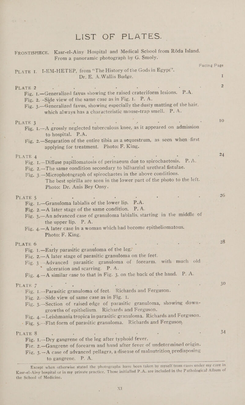 ict OF PLATES. FRONTISPIECE. Kasr-el-Ainy Hospital and Medical School from Réda Island. From a panoramic photograph by G. Smoly. n : 2 : F Facing Page PLATE I. I-EM-HETEP, from “The History of the Gods in Egypt”. Dr. E. A. Wallis Budge. I PLATE 2 yer : ; ; ; A : 2 Fig. 1.—Generalized favus showing the raised crateriform lesions. P.A. Fig. 2..-Side view of the same case as Tit bee be es Ne Fig. 3.—Generalized favus, showing especially the dusty matting of the hair, which always has a characteristic mouse-trap smell. P.A. PLATE 3 ; ; 10 Fig. 1.—A grossly neglected tuberculous knee, as it appeared on admission to hospital. P.A. Fig. 2.—Separation of the entire tibia as a sequestrum, as seen when - first applying for treatment. Photo: F. King. PLATE4 : . ; ; : ; : : 24 Fig, 1.—Diffuse papillomatosis of perinaeum due to spirochaetosis. P.A. Fig. 2.—The same condition secondary to bilharzial urethral fistulae. Fig. 3.—Microphotograph of spirochaetes in the above conditions. The best spirilla are seen in the lower part of the photo to the left. Photo: Dr. Anis Bey Onsy. PLATE 5 . fe : ‘ d @ , A 26 Fig. 1.—Granuloma labialis of the lower lip. PAA. Fig. 2.—A later stage of the same condition. P. A. Fig. 3.—An advanced case of granuloma labialis, starting in the middle of - the upper lip. P. A. Fig. 4.—A later case in a woman which had become epitheliomatous. Photo: F. King. PATE 6 : : : ; ; ; 2 , 28 Fig. 1.—Early parasitic granuloma of the leg. : Fig. 2.—A later stage of parasitic granuloma on the feet. Fig. 3--Advanced parasitic granuloma of forearm, with much old ulceration and scarring. P. A. Fig. 4.—A similar case to that in Fig. 3. on the back of the hands. Py PEALE 7 ; py : ‘ : 3 : : 30 Fig. 1.—Parasitic granuloma of feet. Richards and Ferguson. Fig. 2.-Side view of same case as in Fig. I. Fig. 3.—Section of raised edge of parasitic granuloma, showing down- growths of epithelium. Richards and Ferguson. Fig. 4. Leishmania tropica in parasitic granuloma. Richards and Ferguson. . Fig. 5.--Flat form of parasitic granuloma. Richards and Ferguson. _ PL Are : P : f ; 34 Fig. 1.—Dry gangrene of the leg after typhoid fever. Fic. 2.—Gangrene of forearm and hand after fever of undetermined origin. Fig. 3.—A case of advanced pellagra, a disease of malnutrition, predisposing to.gangrene. P. A. Except when otherwise stated the photographs have been taken by myself trom cases under my care in Kasr-el-Ainy hospital or in my private practice, Those initialled P.A. are included in the Pathological Album of the School of Medicine.