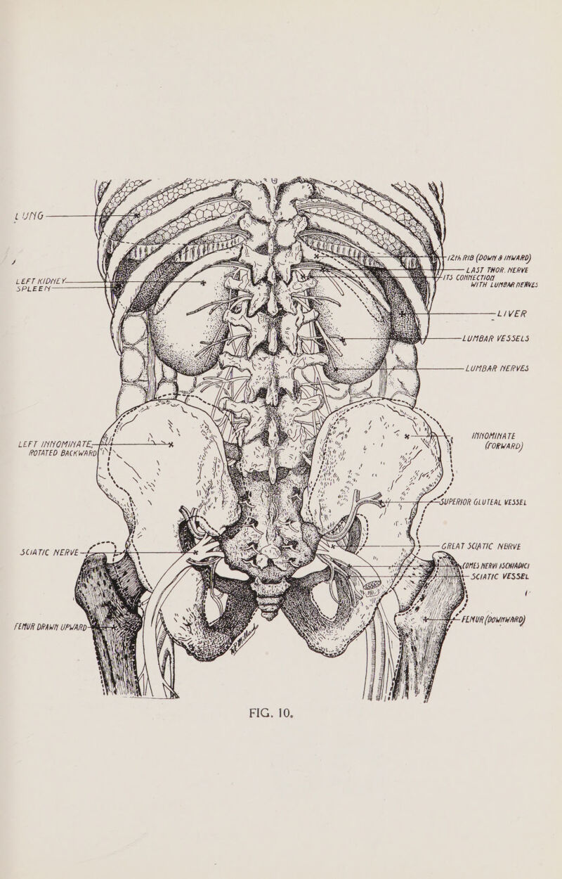 LUNG aN — “EA SDS Sos ; l Sea X IN (2th RIB (DOWN 8 INWARD) wre NAS ; I LAST THOR. NERVE LEFT KIDNE Y- PMSF SS SY, SS SPLEEN —-LIVER LUNBAR VESSELS LUMBAR NERVES INNOMINA TE LEFT INNOMINATE; (FORWARD) ROTATED BACKWARD| ‘| WA A , ig J ca ~ FENUR (DOMIHARD) a) \ Coa FEMUR DRAWN UPWARD-W