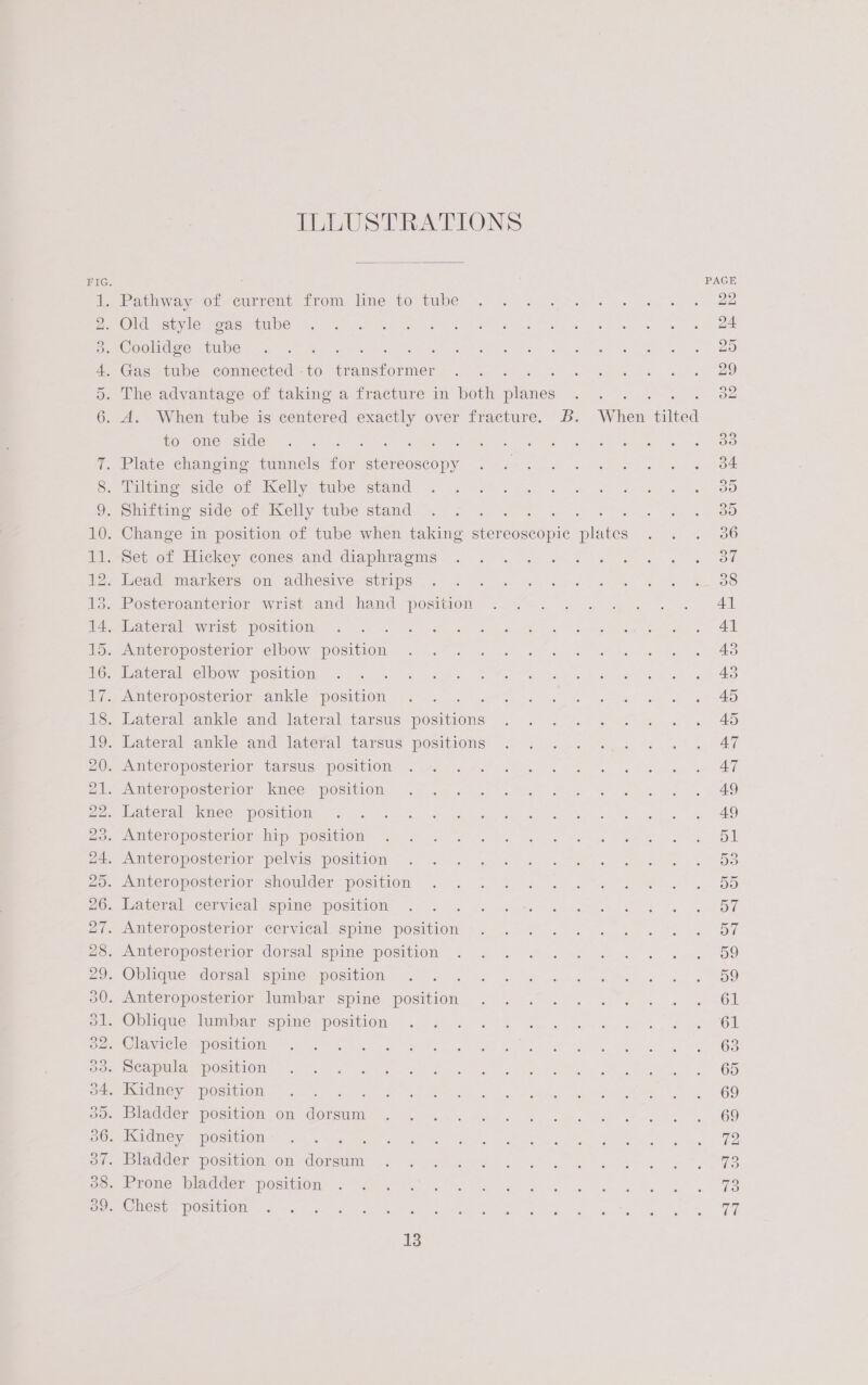 im &amp; S&amp;S Ol Rm GO ID — &amp; COMmLS AND Of Bey Wb) WY) Cy Wes) WS WH) Ws) wo eS Is we) ILLUSTRATIONS s PAGE a eothiway or current. Tro, lame; tol tube: 0 (9s ta ew be eo Oldies Ue) Fo re as ee a ee a, es Coolidge tube . .. Dl Oe Pe ee eh ee Gas tube connected - to arabe: Je Se a ee The advantage of taking a fracture in both ne adamant. hae A. When tube is centered exactly over fracture. Bb. When tilted to one side : ite 30 . Plate changing tunnels for sioreeccope 34 . Tilting side of Kelly tube stand 30 . Shifting side of Kelly tube stand ita 30 . Change in position of tube when taking Seneca lite 36 . Set of Hickey cones and diaphragms ov . Lead markers on adhesive strips 38 3. Posteroanterior wrist and hand position 4] meiera lh WRISt) POSIUIODs Uc. 1.38 ool Le Es ays. oe ha ce 8) age ae aE Teanberoposversor elbow position: 4 277 «7 Jeo6 os a wt a ee a A Peer A elOO We OSTUOM ete... seh aes “oe Mee eit a eo sak a ne ee eer OPOSLOMIOL Amie’ POSMON | se o.q Le gota ae: ee =e ee ae 4D Pbaveralcatkle andmaveral farsi pOSiuOls. | o. 2. sca &amp; (fo 26 a. 40 . Lateralgnkle and lateral tarsus positions . 2s 2. ./: «3° 47 PU MMLerOpOSterLOor- tarcus) Positiom= Fy i.e. 2k ee ae ne ee AE PELMECLOVOSLCTION “UMCGs POSTUIONs 1 oe g-gl) at ese oe eee 2 AO eliawerale nice a POSMRIONs «gisele. A nc gee elene ae? Rn eye ay AO a VENOpPOSherlOra hin POStIOW So oso. oq: ee ae Sena ae ee og PE mUChOMOSreMOn pelvis, WOsittOml pr! a 80S) o. fe a 2s, PRO eet OS E miiperopesterior showlden= position: «93523. 5 ee oP ve ee BD elravenal. Cermcal «Spine, POSttlOM../.-..&gt; ok Pa ee 1S Ae, ey ad OF S everopOsierior cervical spite POsimOm 4). - 62s. Ges se -AnLeropostenior dorsal spine positiom 2. &amp; 4 oe e-news DD = Obleme cdorsal spies position, 220.5 .: 2. 2 secs oO _ -eticeroposterior vluiibar spine. postiioh .—. -.7 2... . -. .- » Gr = Obhques limbariepime position. ..2 &lt; 3°.) son eee. ew OL OL WACloPpOSI MOU E =e Aer gt Gres he Bet ek ee a RO ee OS Pe cael eMC SMON ems. Seven ieee! PA ee ED a MOA mee. eG Se ele O OS MOM ene i ue cet neg it ne a ac. Ptah a CNS &gt; Wane) OD sbiadder positron. Om donsim Us peo 5 ds ao Ub Woe Ae a 69 pe CMC TOOSIUION cor kc tes oe 80 ey aaa goon ge eld. omer 7 Adder POSHOn On SOLS 6 x seleeg 8 Gas. Von enn oe eS Pee Oe Madden DOstiione iat eet el oe ae ke PCWocte POSUIOME ws =n aloe ee tee, We OR