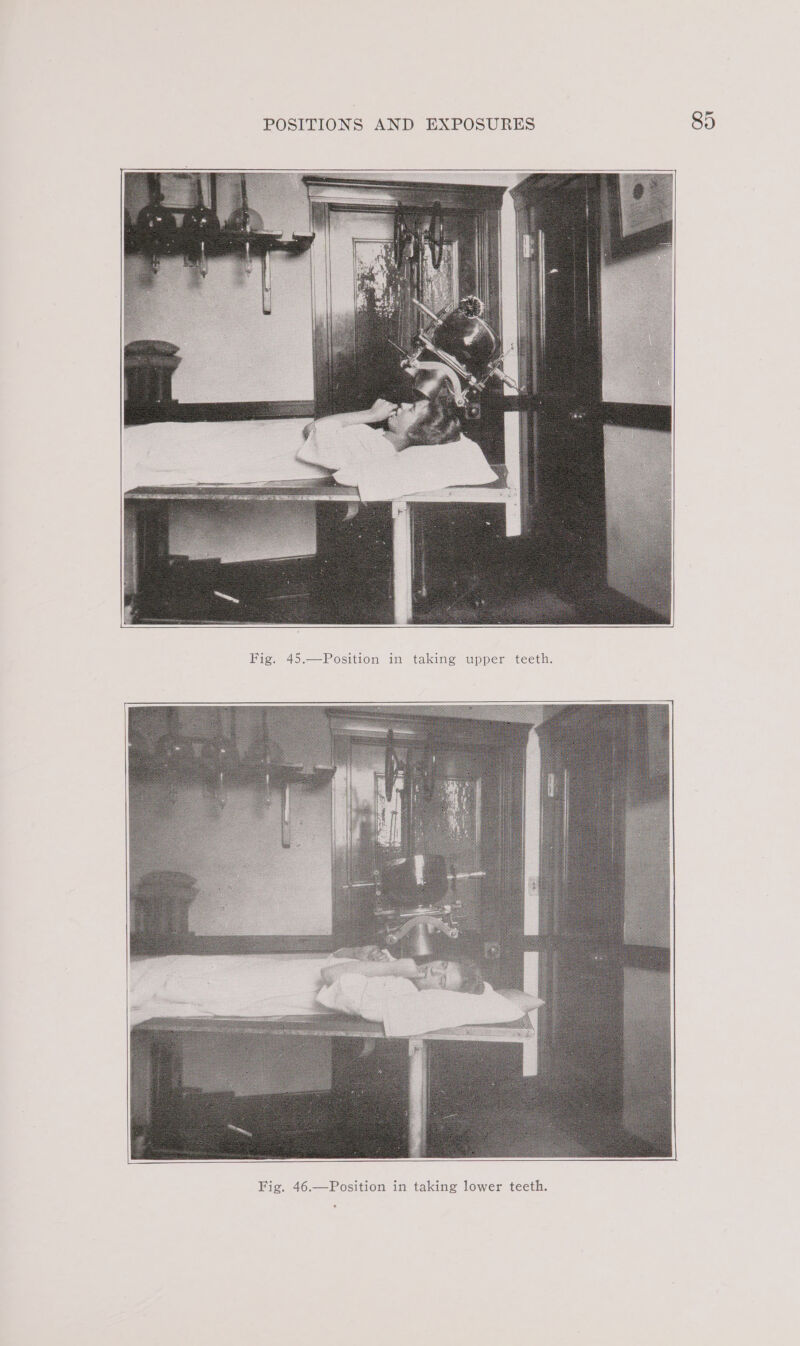 Fig. 45.—Position in taking upper teeth.