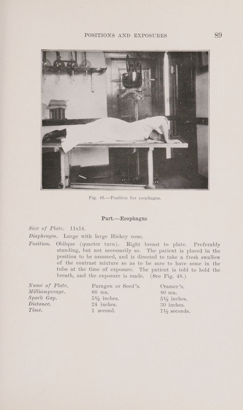 Part.— Esophagus Position. Oblique (quarter turn). Right breast to plate. Preferably standing, but not necessarily so. The patient is placed in the position to be assumed, and is directed to take a fresh swallow of the contrast mixture so as to be gure to have some in the tube at the time of exposure. The patient is told to hold the breath, and the exposure is made. (See Fig. 48.) Name of Plate. Paragon or Seed’s. Cramer’s. Milliamperage. 60 ma. SO ma. Spark Gap. 514 inches. 51% inches. Distance. 24 inches. 30 inches.