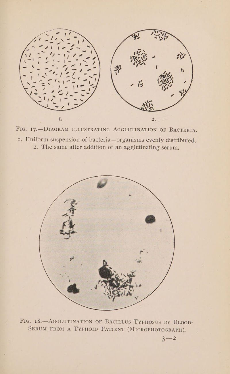 Fic. 17,—DIAGRAM ILLUSTRATING AGGLUTINATION OF BACTERIA. I, Uniform suspension of bacteria—organisms evenly distributed. 2. The same after addition of an agglutinating serum. Fic. 18.—AGGLUTINATION OF BACILLUS TyPHosUS BY BLOOD- SERUM FROM A TYPHOID PATIENT (MICROPHOTOGRAPH), Bae