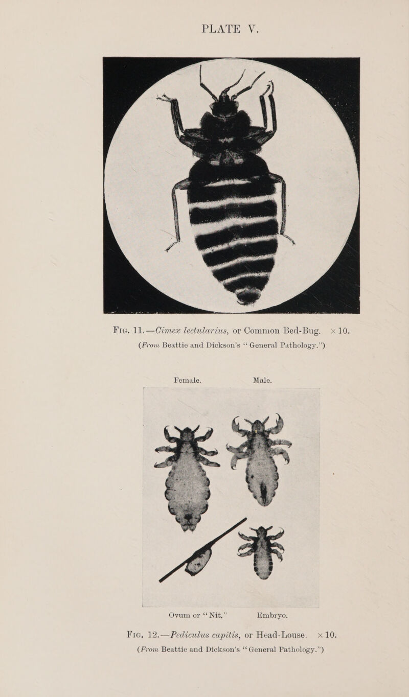 Fie. 11,—Cimex lectularius, or Common Bed-Bug. x 10. (From Beattie and Dickson’s ‘‘ General Pathology.’) Female. Male. Fic. 12.—Pediculus capitis, or Head-Louse. x 10.