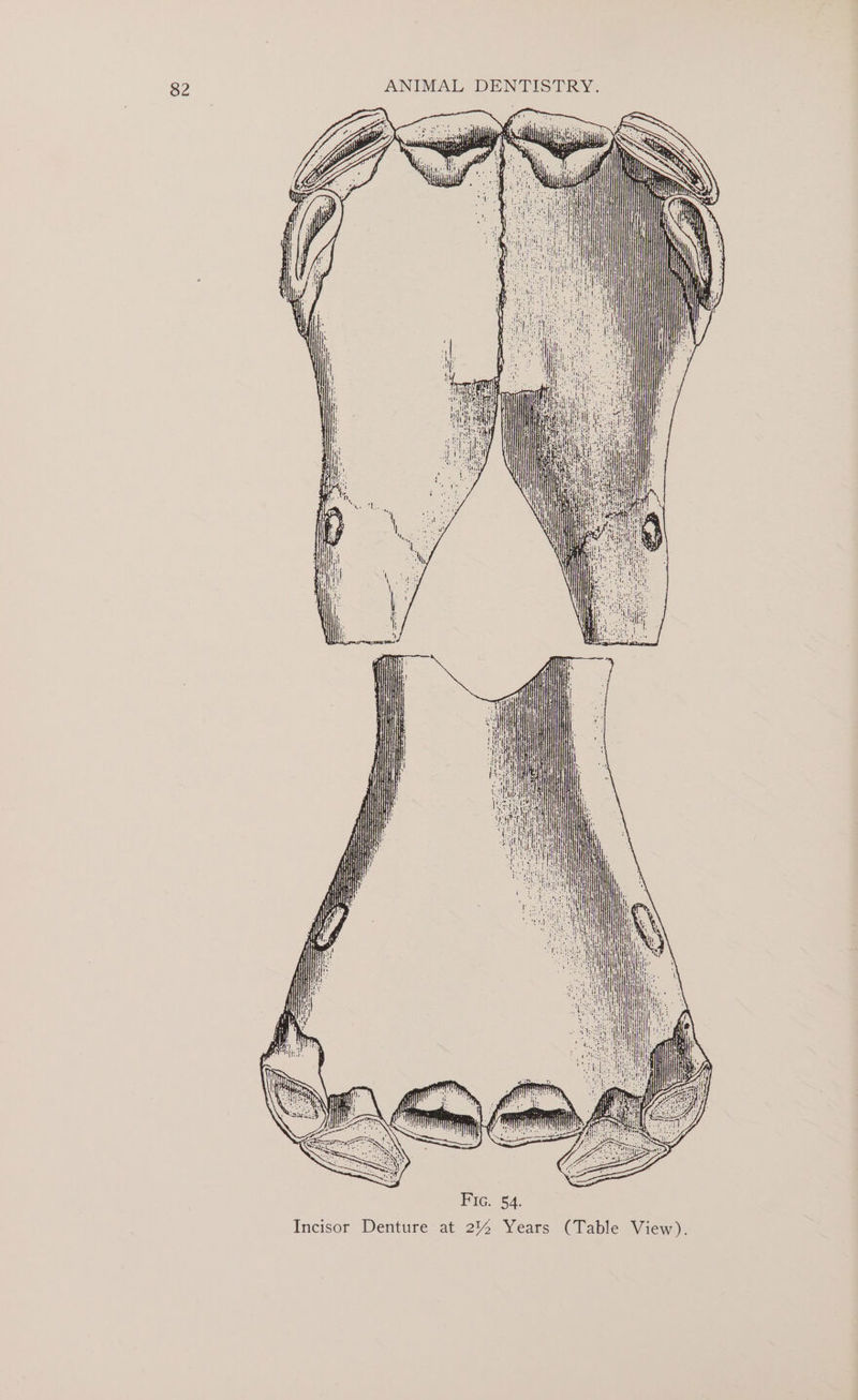 Incisor Denture Fig. $4. at 2% Years (Table View).